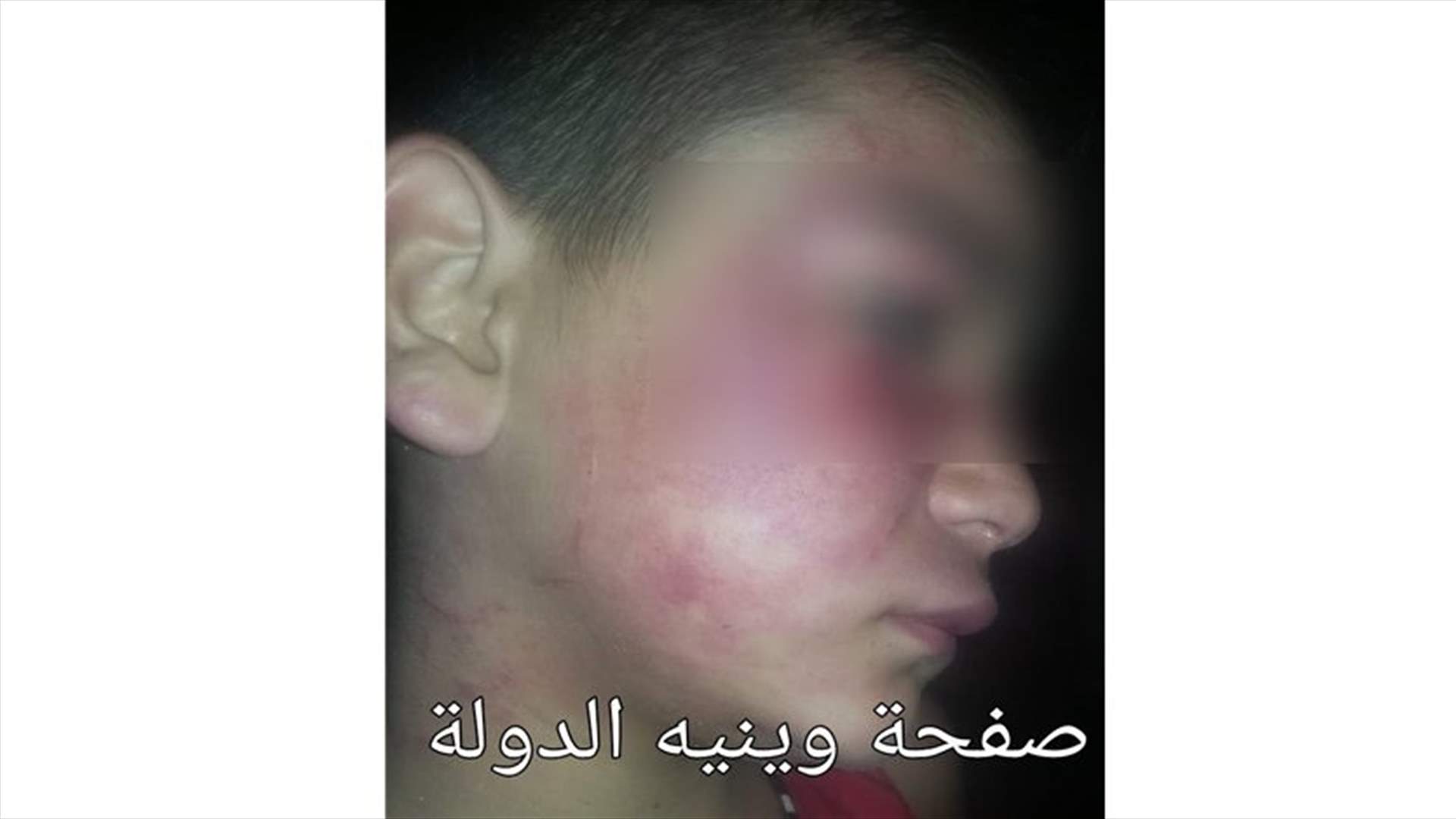 Father tortures his children with electric wires-[PHOTOS]