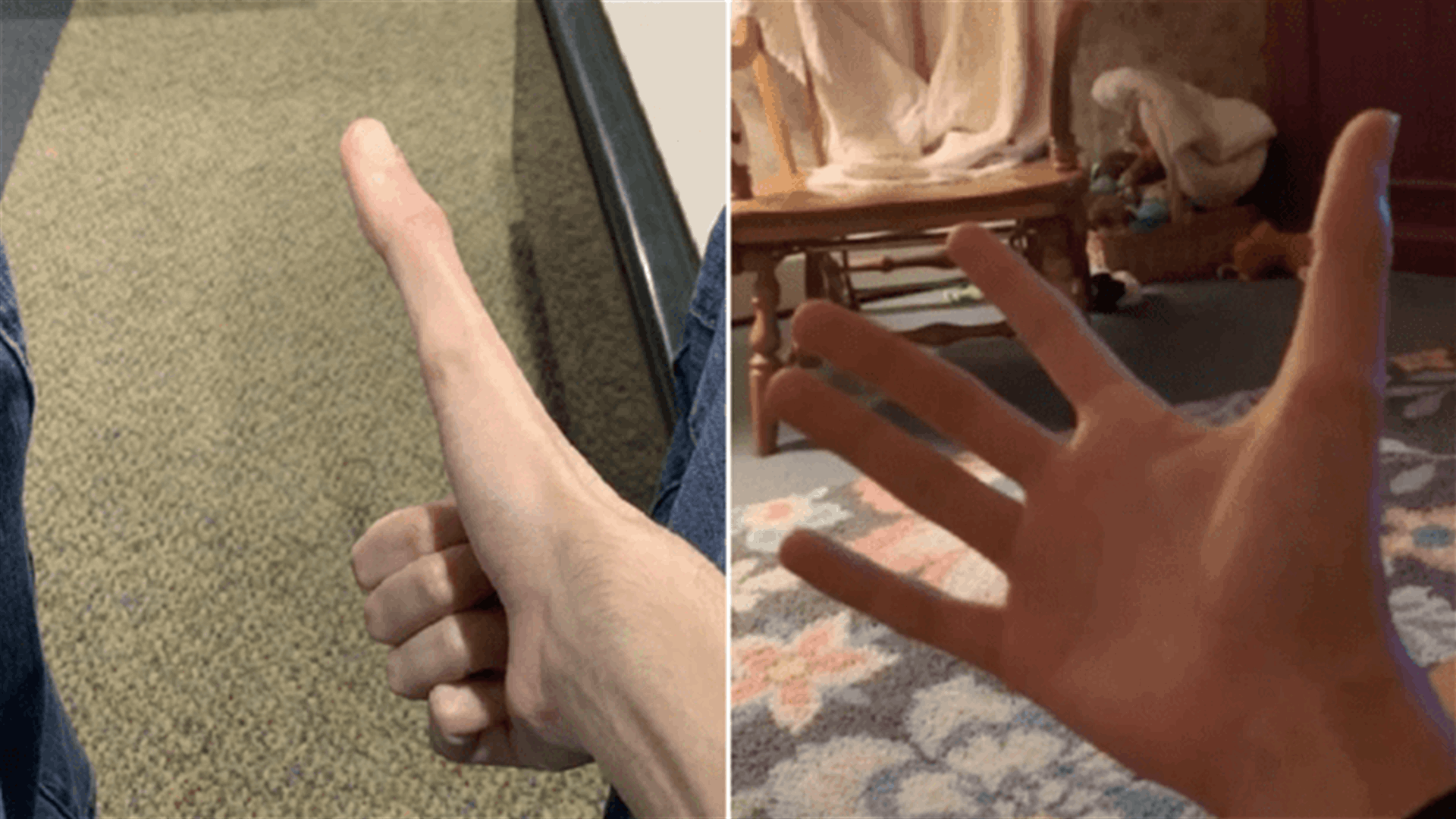 طالب أثار الضجة على الإنترنت... بسبب طول إبهامه!