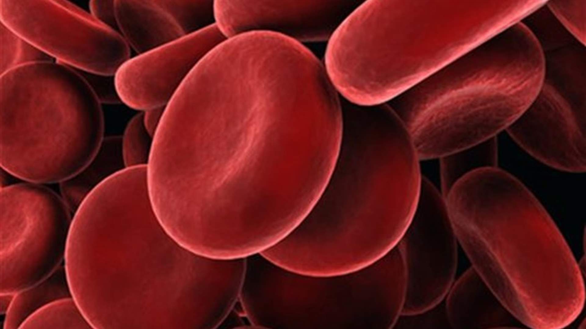 دم فتاة يتحوّل إلى اللون الأزرق... والسبب مسكن آلام الأسنان