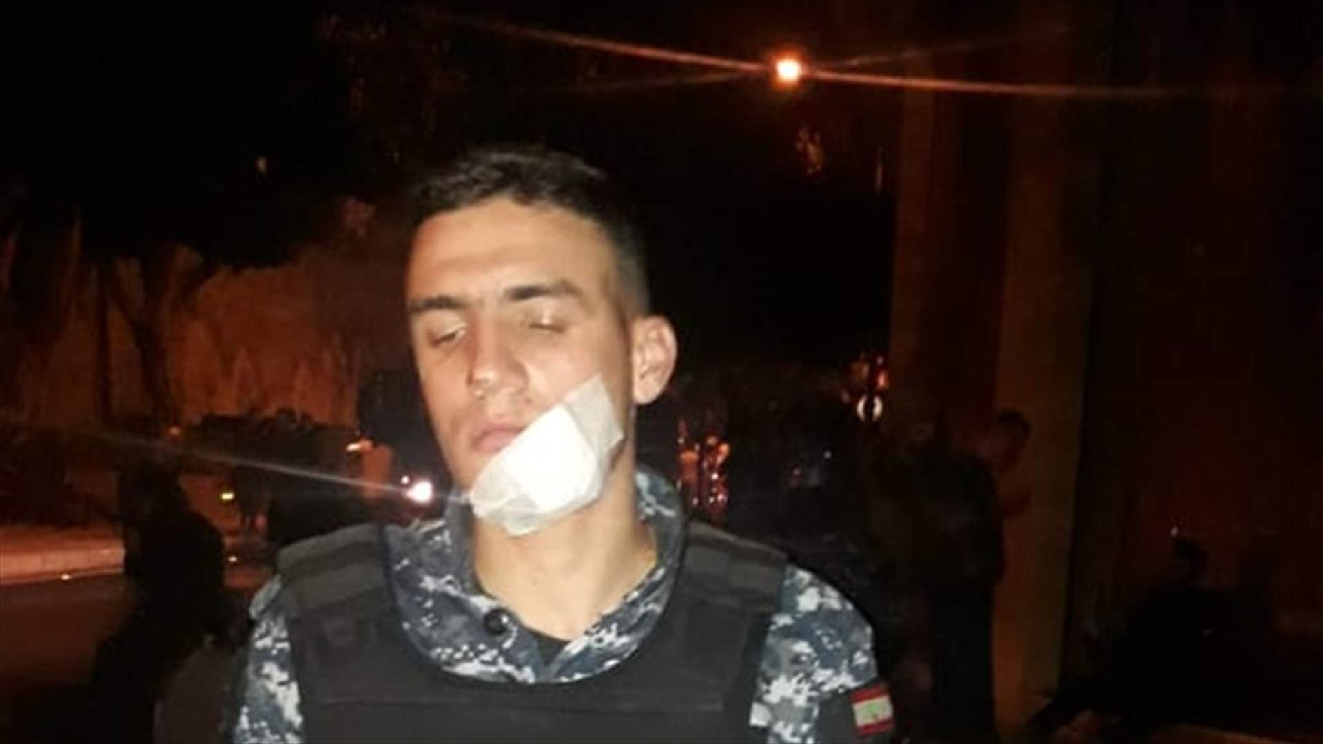قوى الأمن تنشر صورًا لبعض الاصابات في صفوف عناصرها