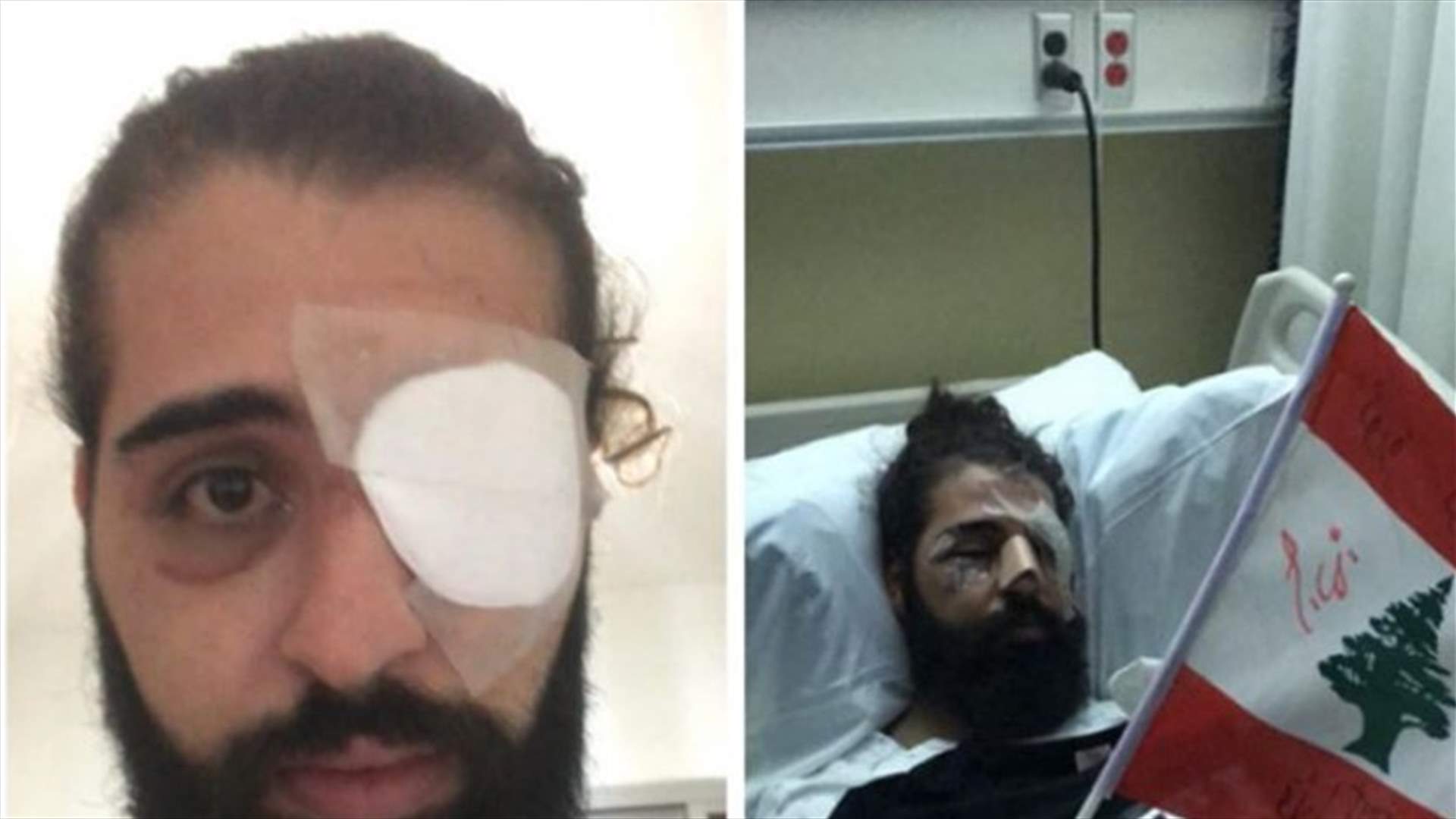 قنبلة مسيّلة للدموع تُطفئ عين جاد... هذا ما حصل معه خلال الثورة (النهار)