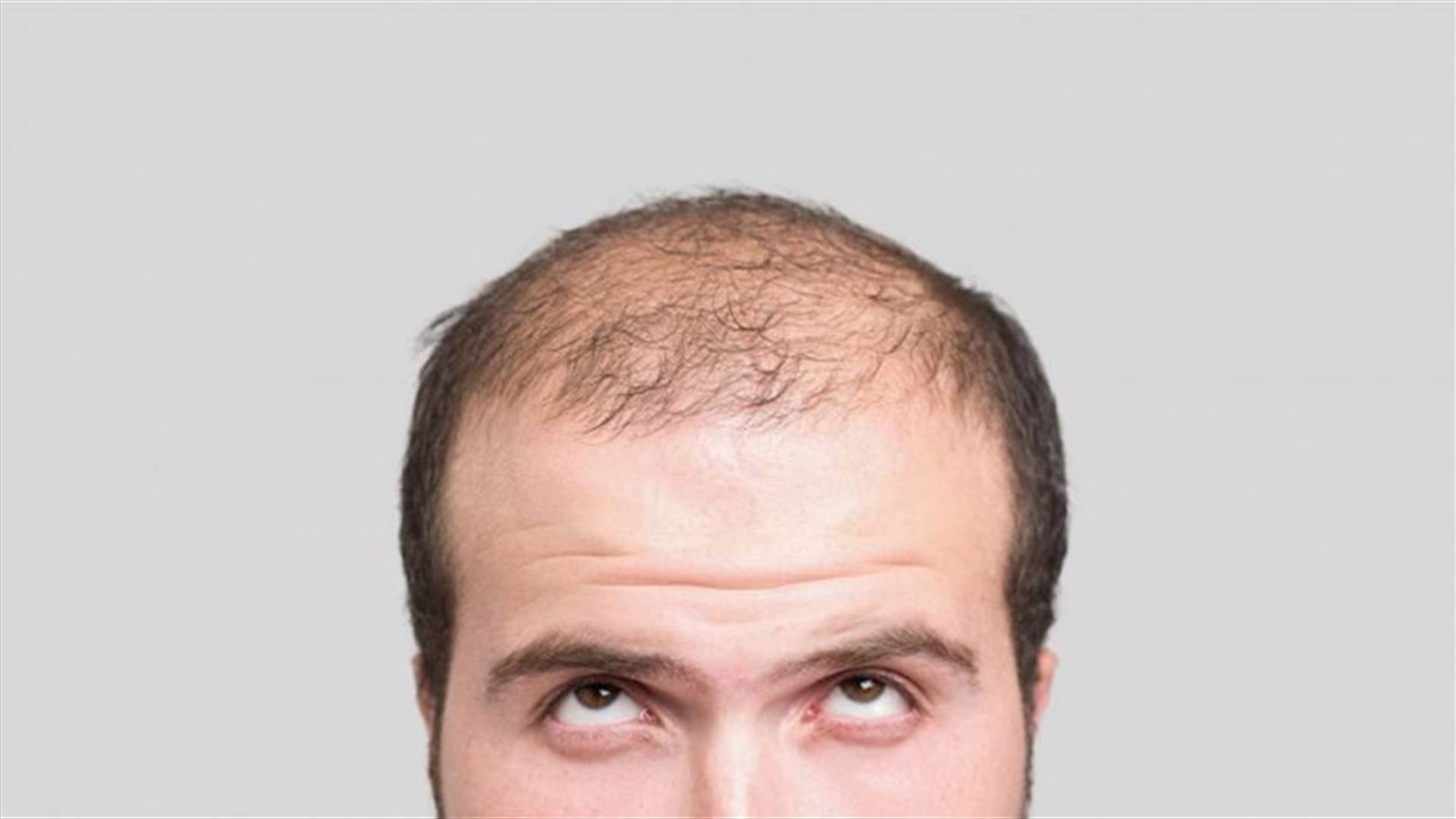 اكتشاف جديد قد يساعد في علاج مشكلة الصلع!