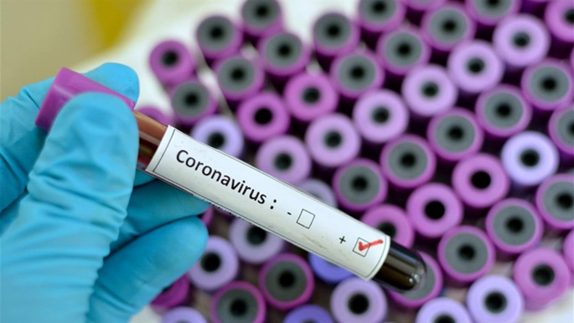 هل تم تأكيد أي حالة لفيروس كورونا في لبنان؟... وهذا ما أوضحته منظمة الصحة العالمية في لبنان