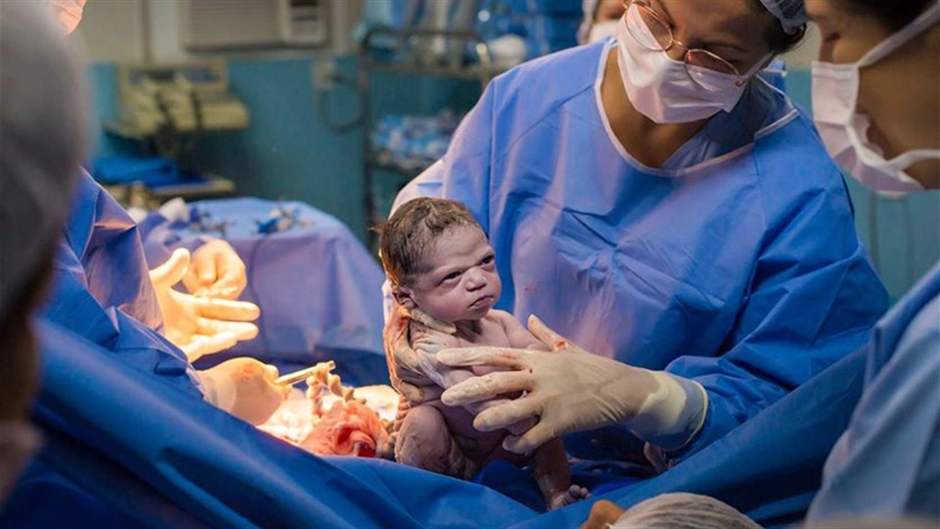 طفلة تجتاح العالم منذ لحظة ولادتها... نظرة عابسة ومن دون بكاء! (فيديو)