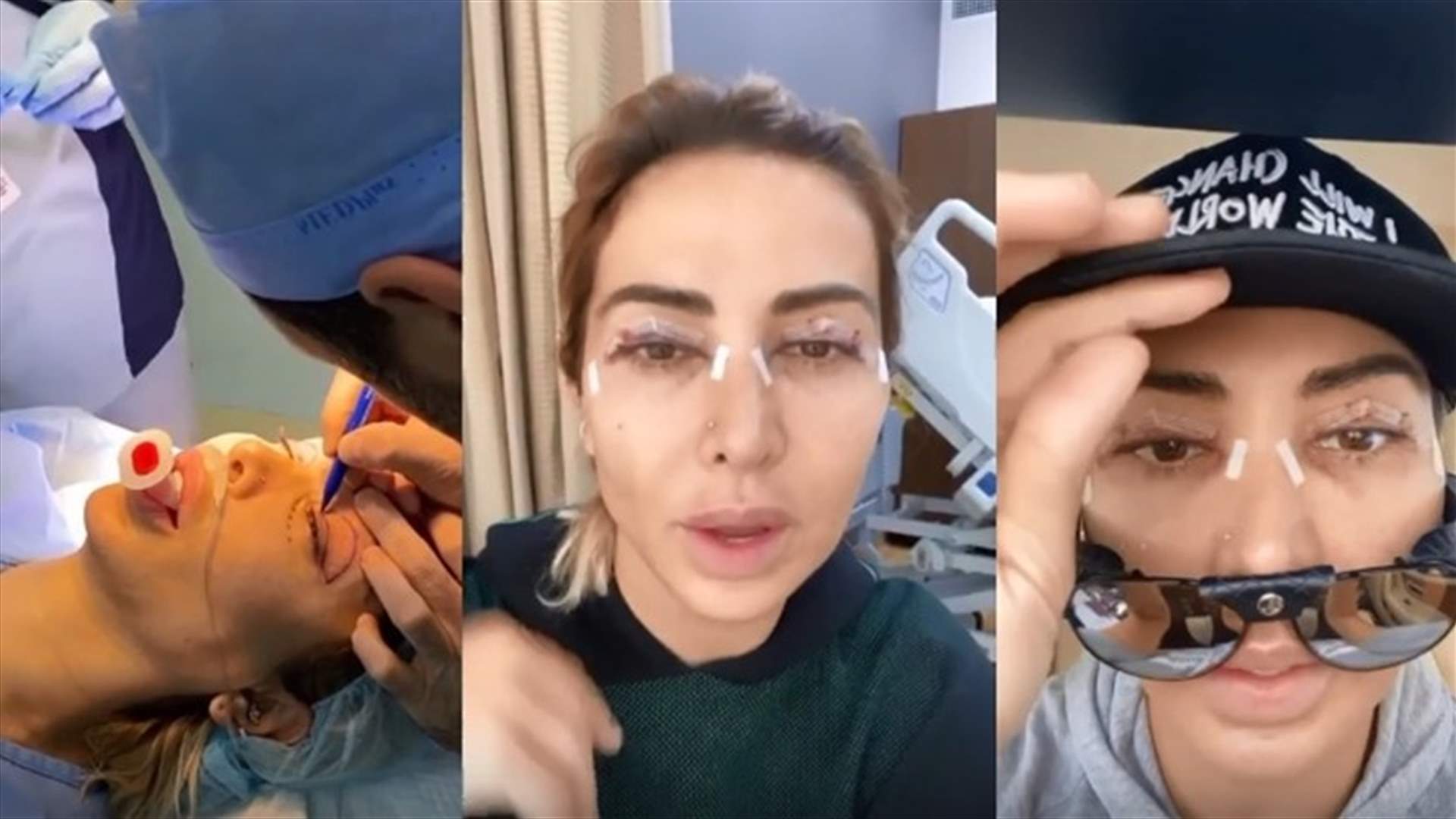 جويل ماردينيان حقنت الدهون تحت عيونها وشدّت جفونها.. صوّرت مراحل العملية بالفيديو
