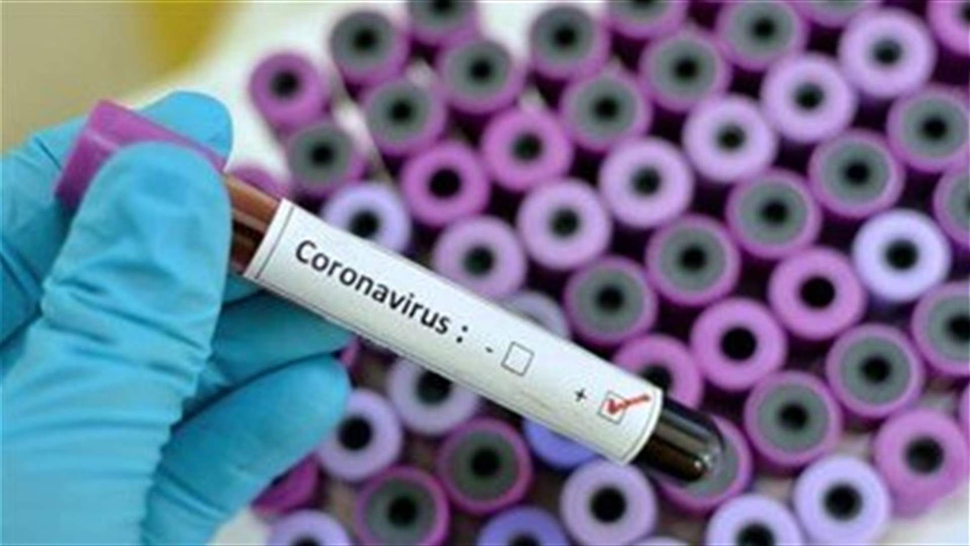 Saudi Arabia reports first coronavirus death, an Afghani resident