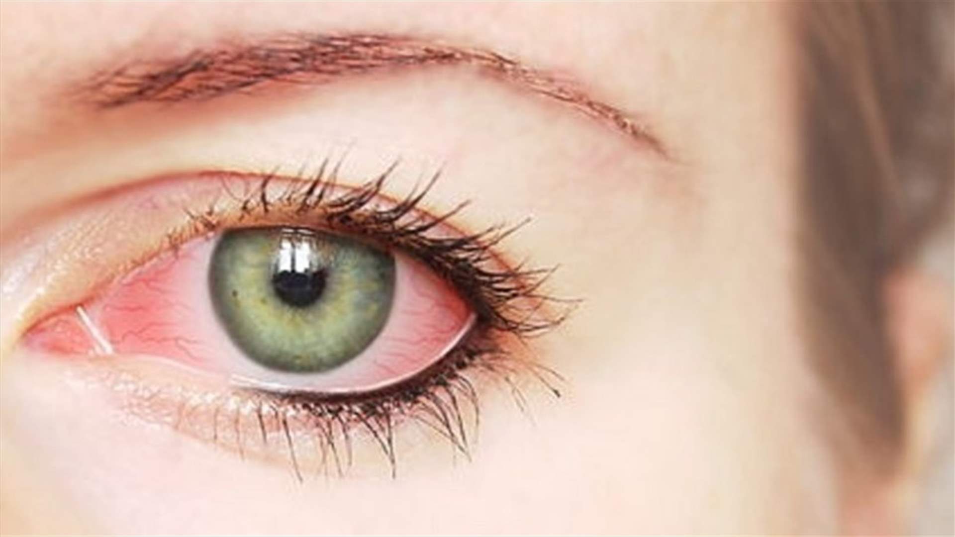 العلماء يكشفون عن علامة محتملة في العين قد تنذر بالإصابة بفيروس كورونا