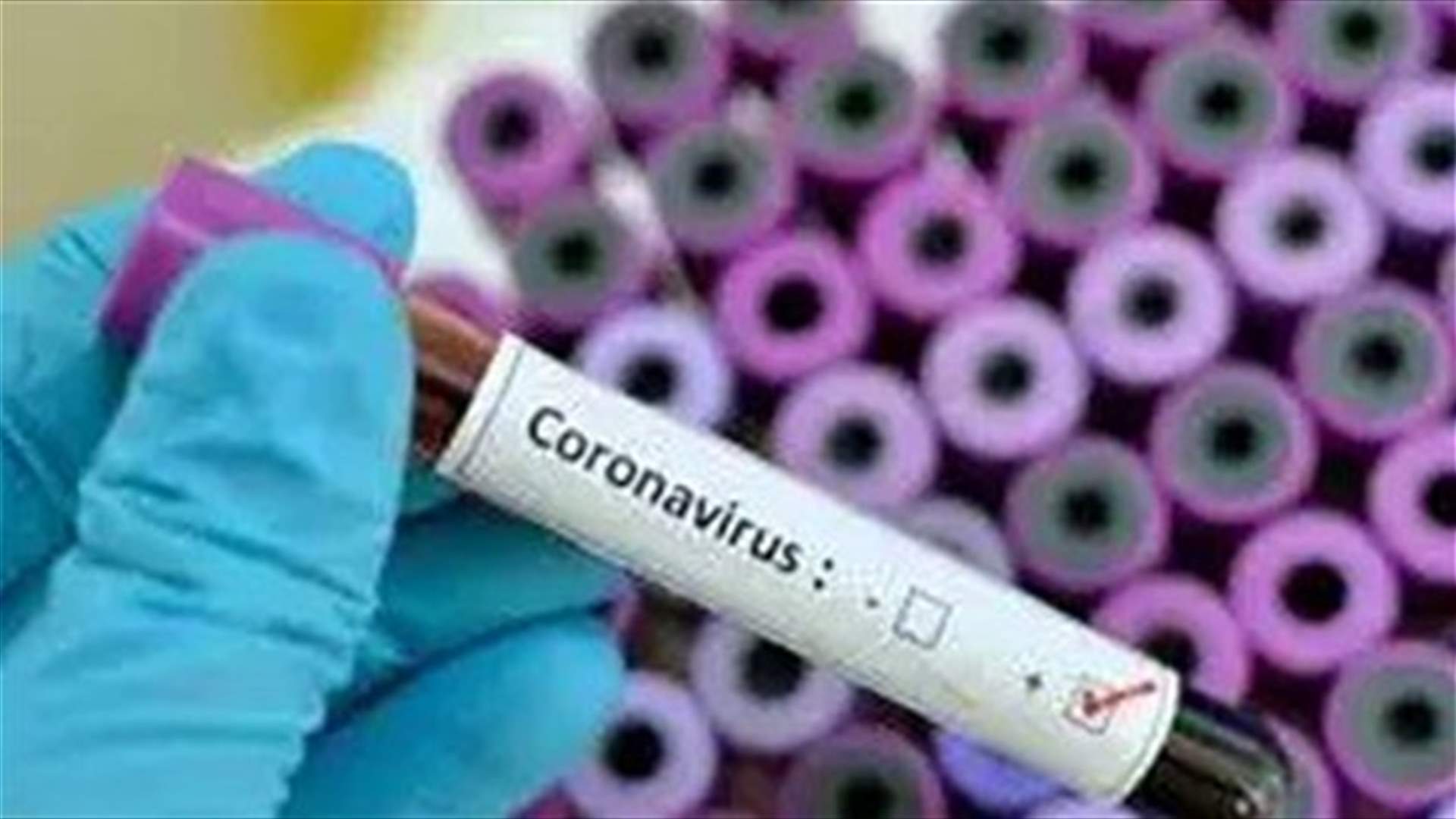 Lebanese doctor dies of Coronavirus in Sao Paulo
