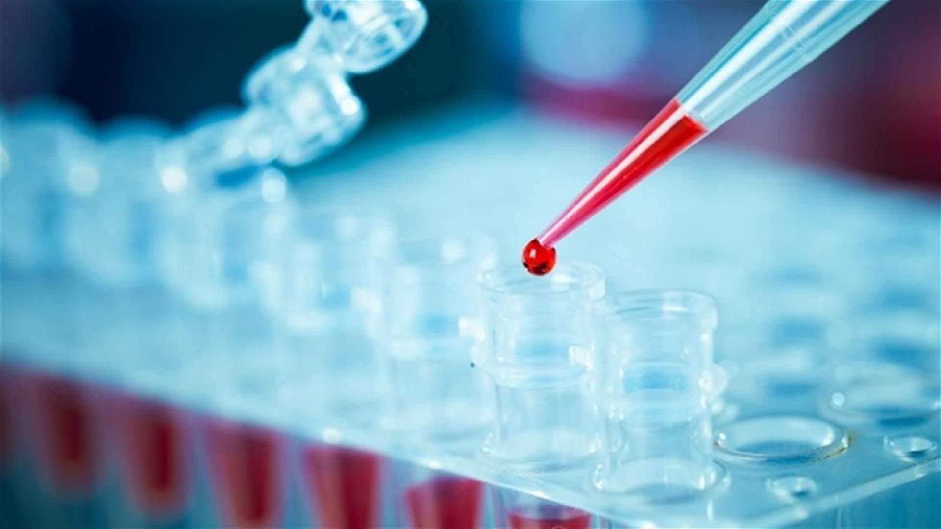 وزارة الصحة عممت لائحة بالمستشفيات المؤهلة لإجراء فحص الـPCR