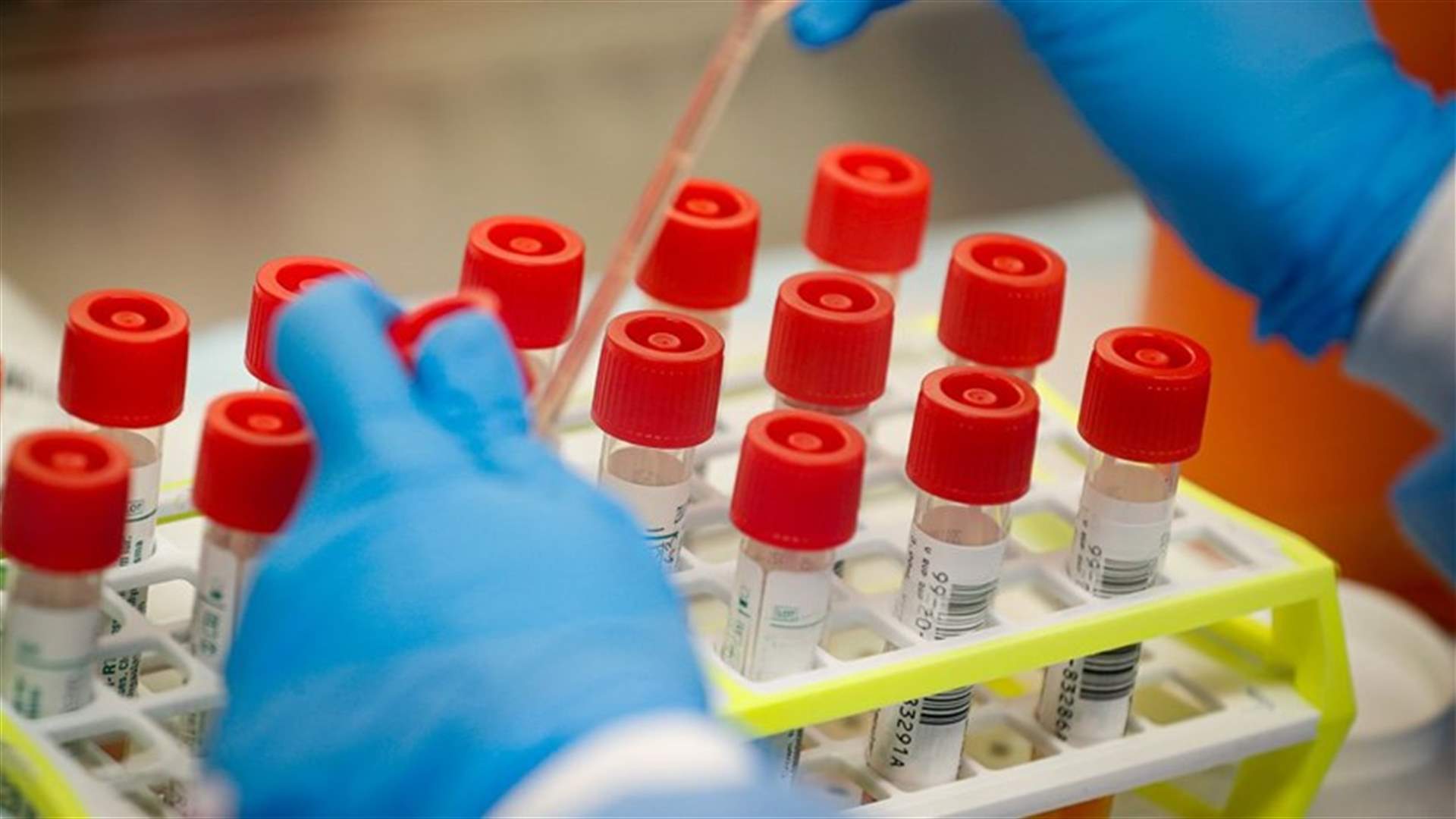 عيادة LAU تجري فحوص PCR مجانية في الكورة
