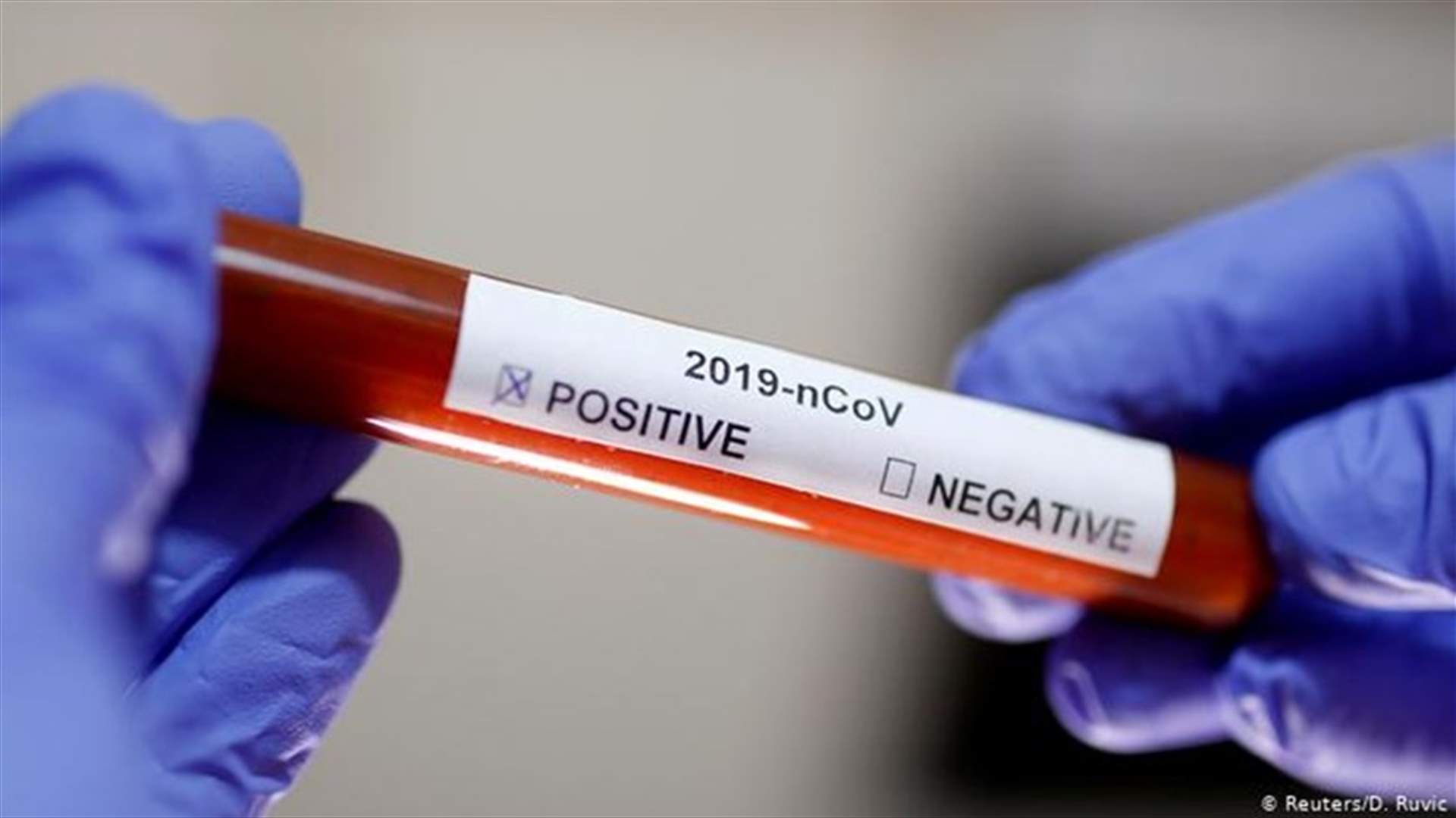 وحدة ادارة الكوارث في صور: تسجيل حالتين مشتبه باصابتهما و4 سلبية وواحدة قيد المتابعة