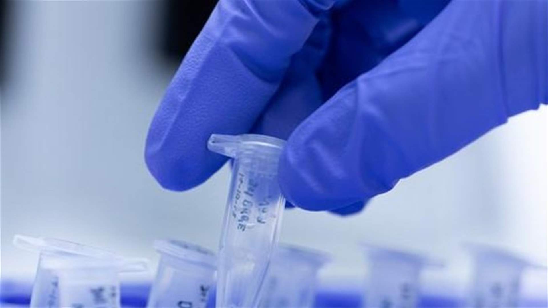 نتائح فحص PCR سلبية للحالة الثانية في جزين