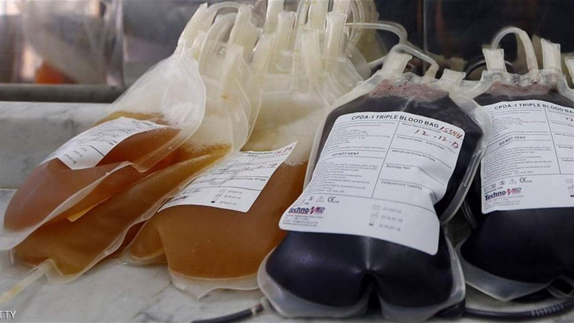 نتائج مشجعة في النمسا لاستخدام البلازما لعلاج مرضى كورونا