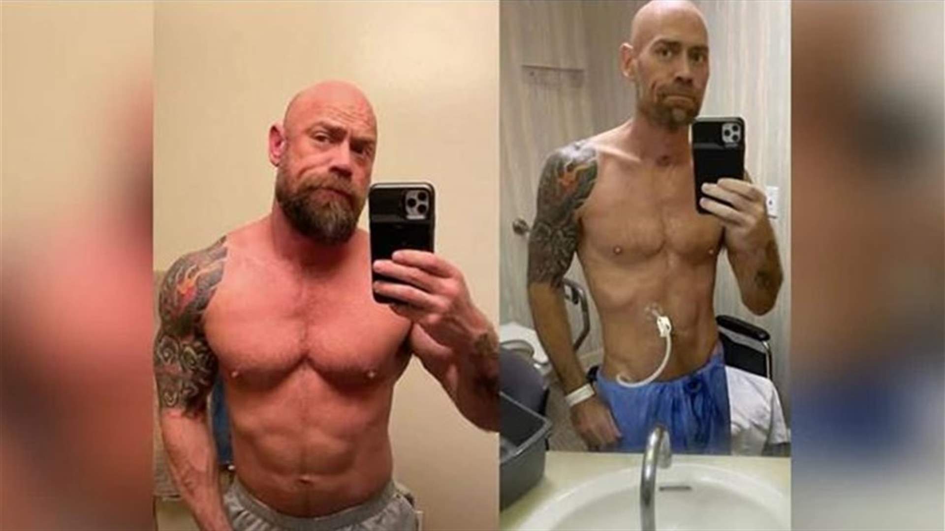 ممرض مفتول العضلات يفاجئ متابعيه بصورة له بعد كورونا... خسر الكثير من وزنه