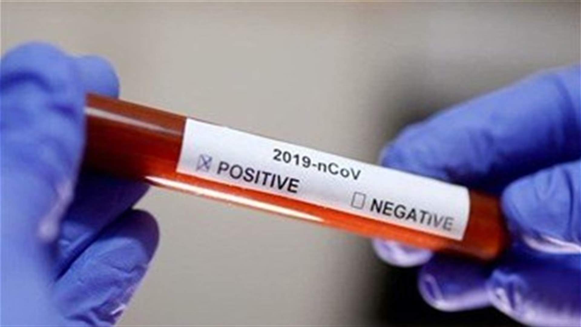 Ministry of Health: Only 11 new Coronavirus cases registered in Lebanon