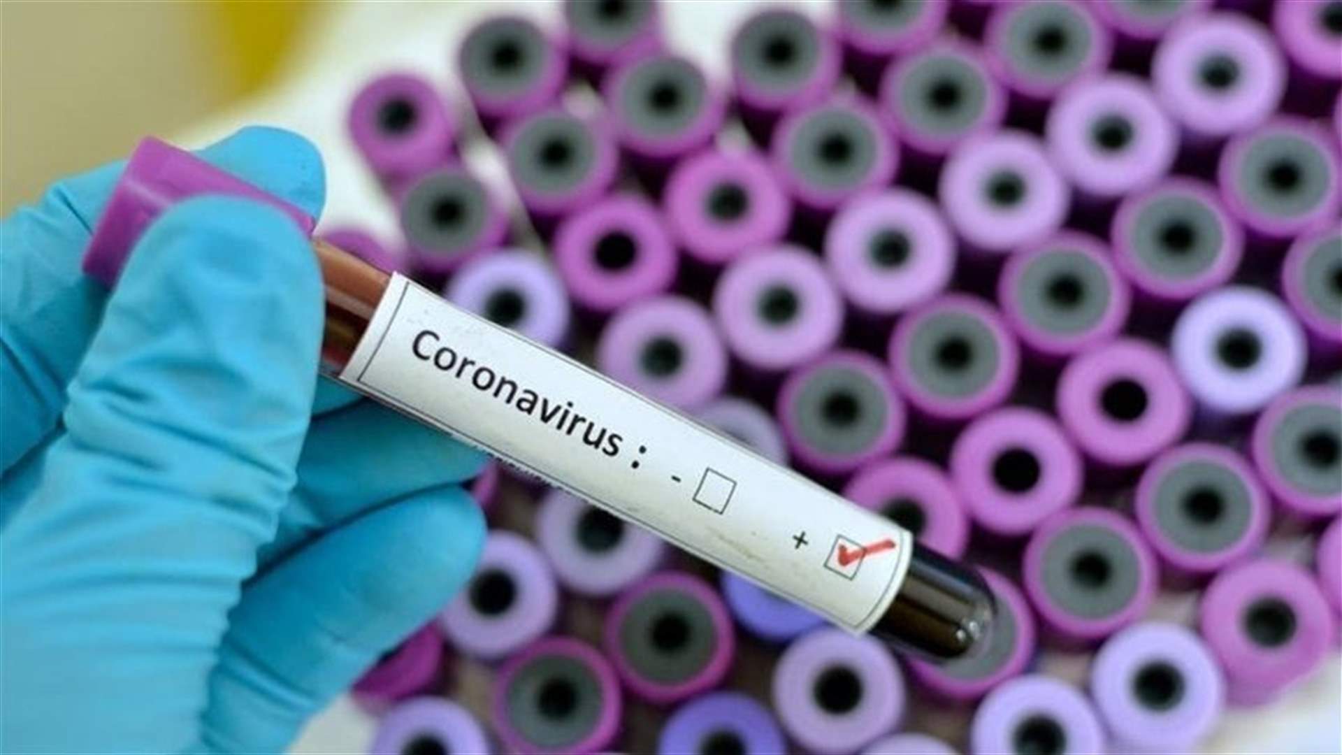 The daily report on coronavirus in Lebanon