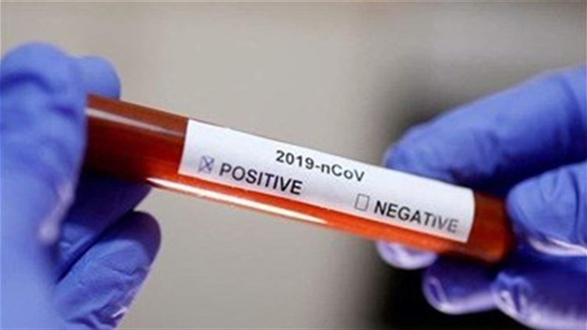 The daily report on coronavirus in Lebanon