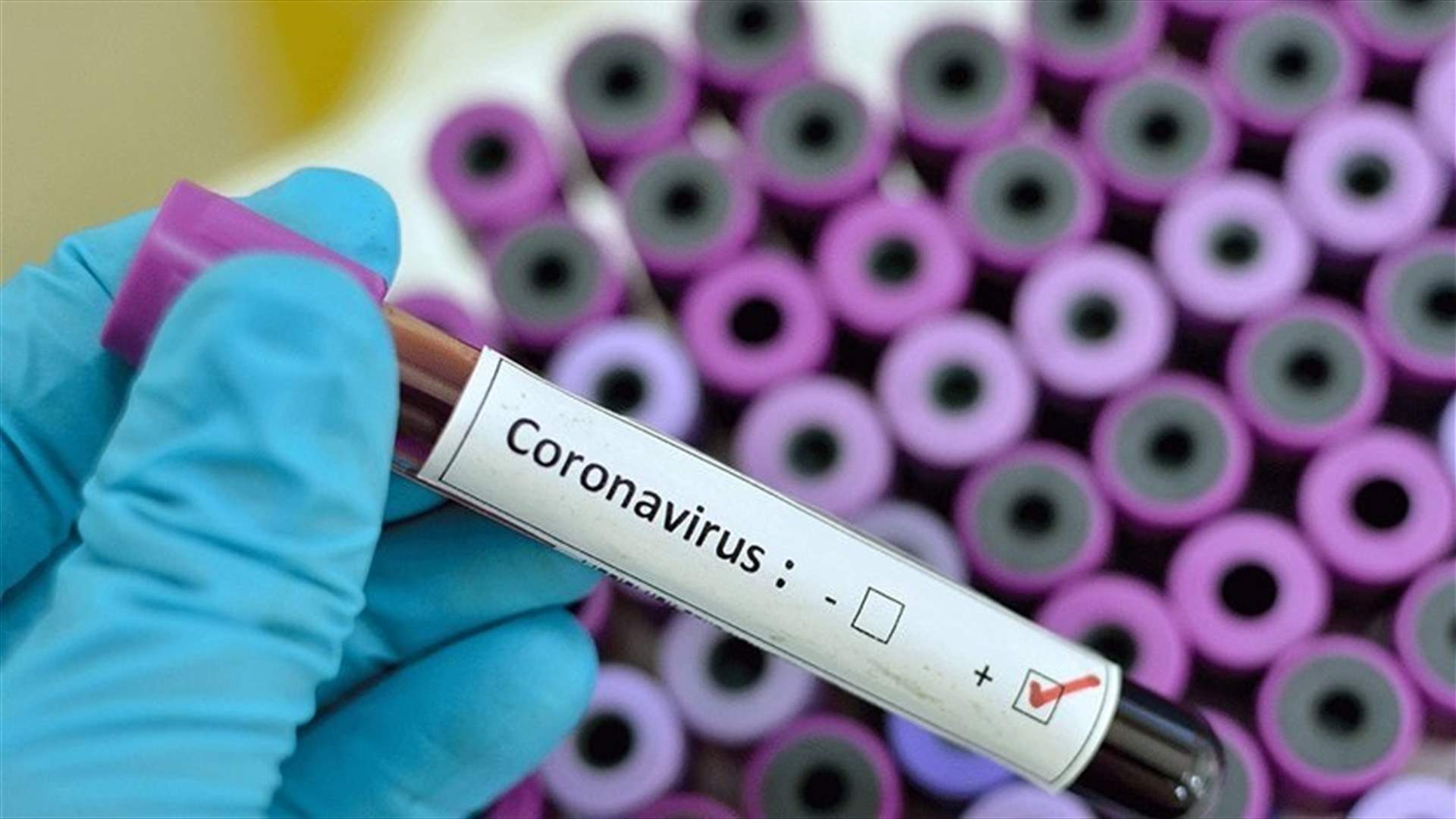 Belgian prince tests positive for coronavirus after attending gathering in Spain