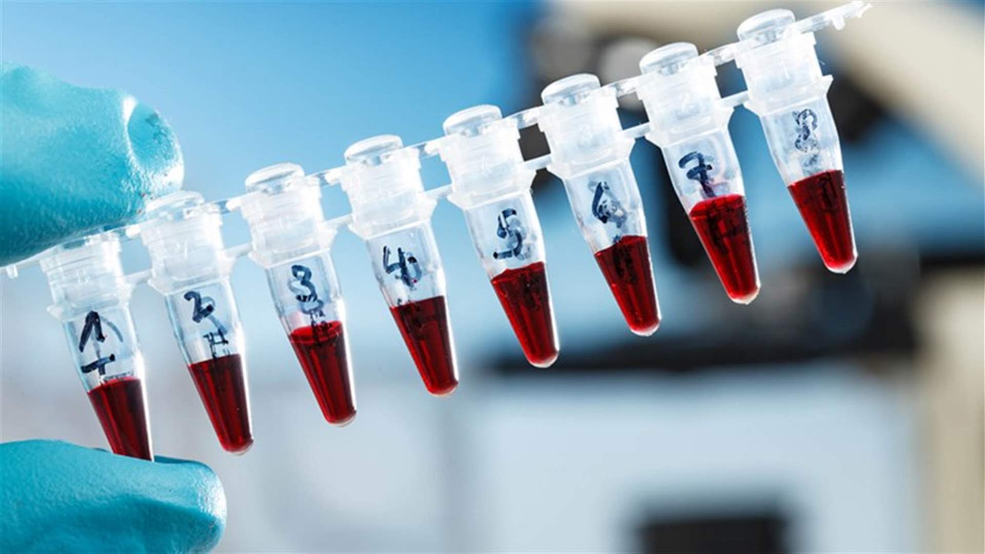 وزارة الصحة أجرت 84 فحص PCR في قبريخا