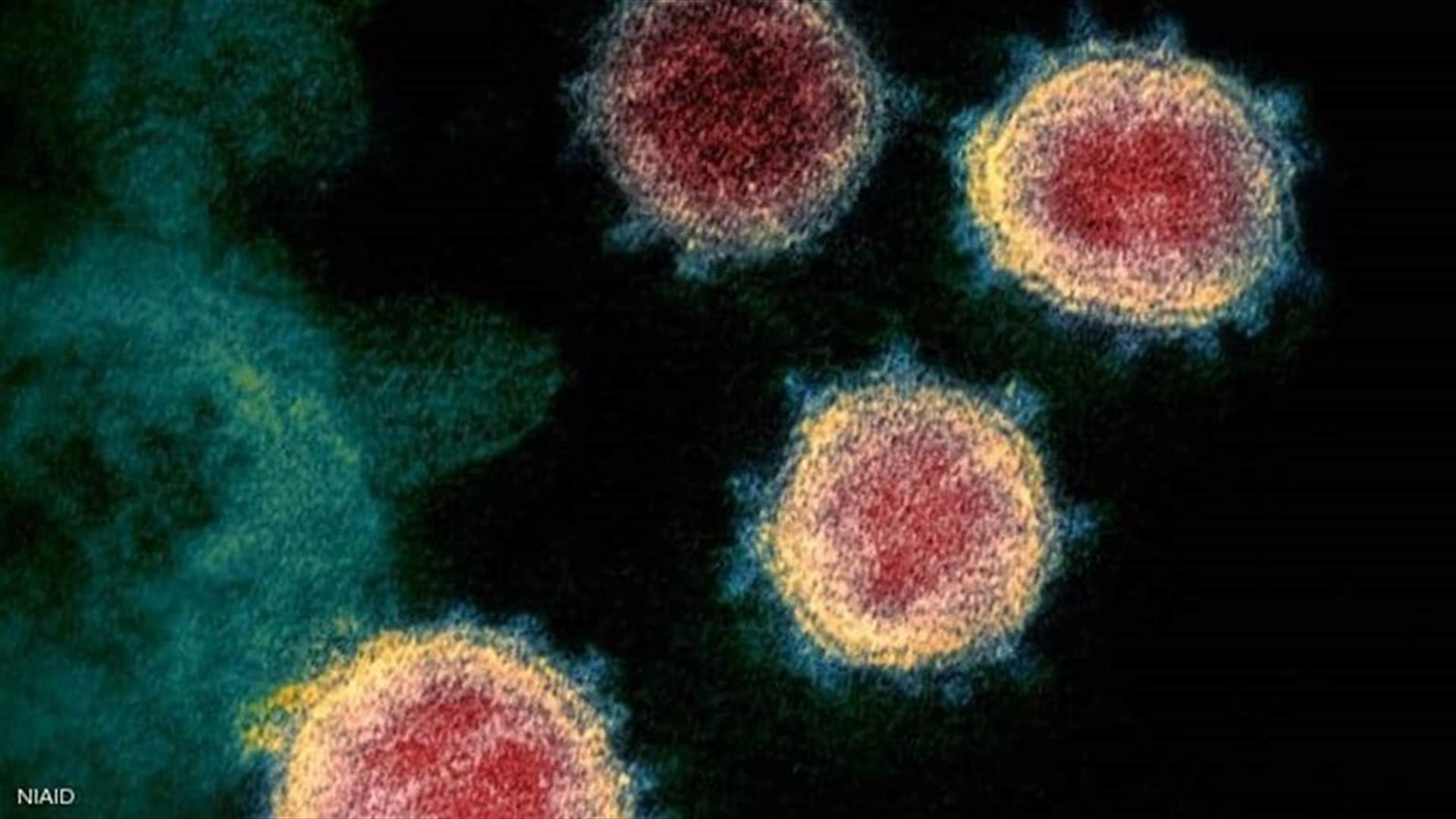 The daily report on coronavirus in Lebanon