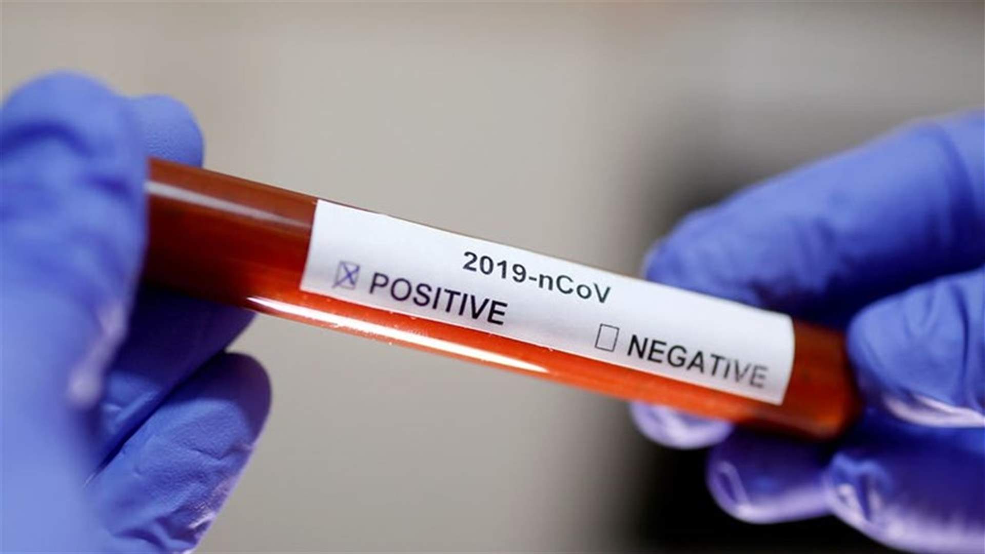 The daily report on coronavirus in Lebanon