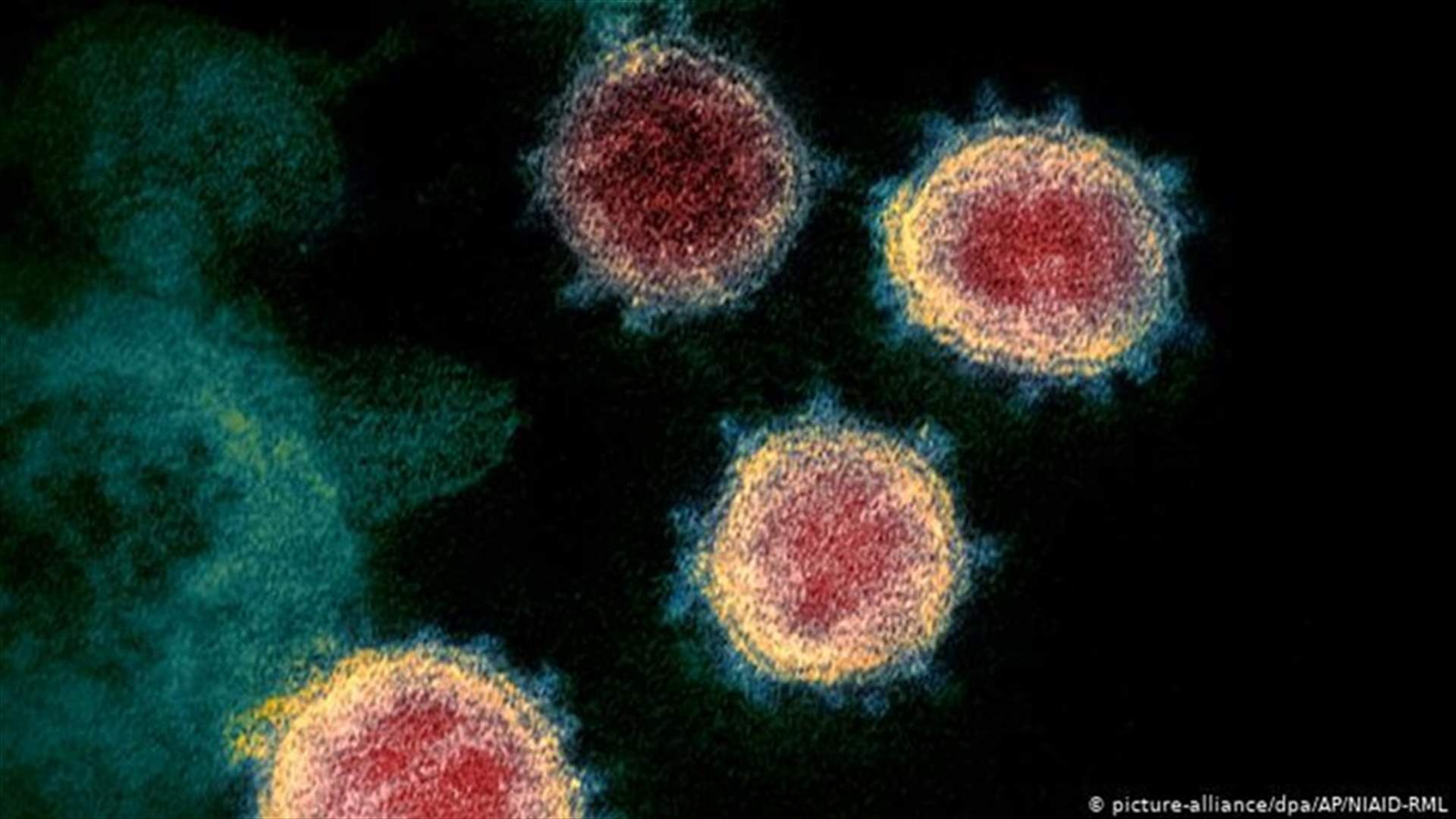 The daily report on coronavirus in Lebanon