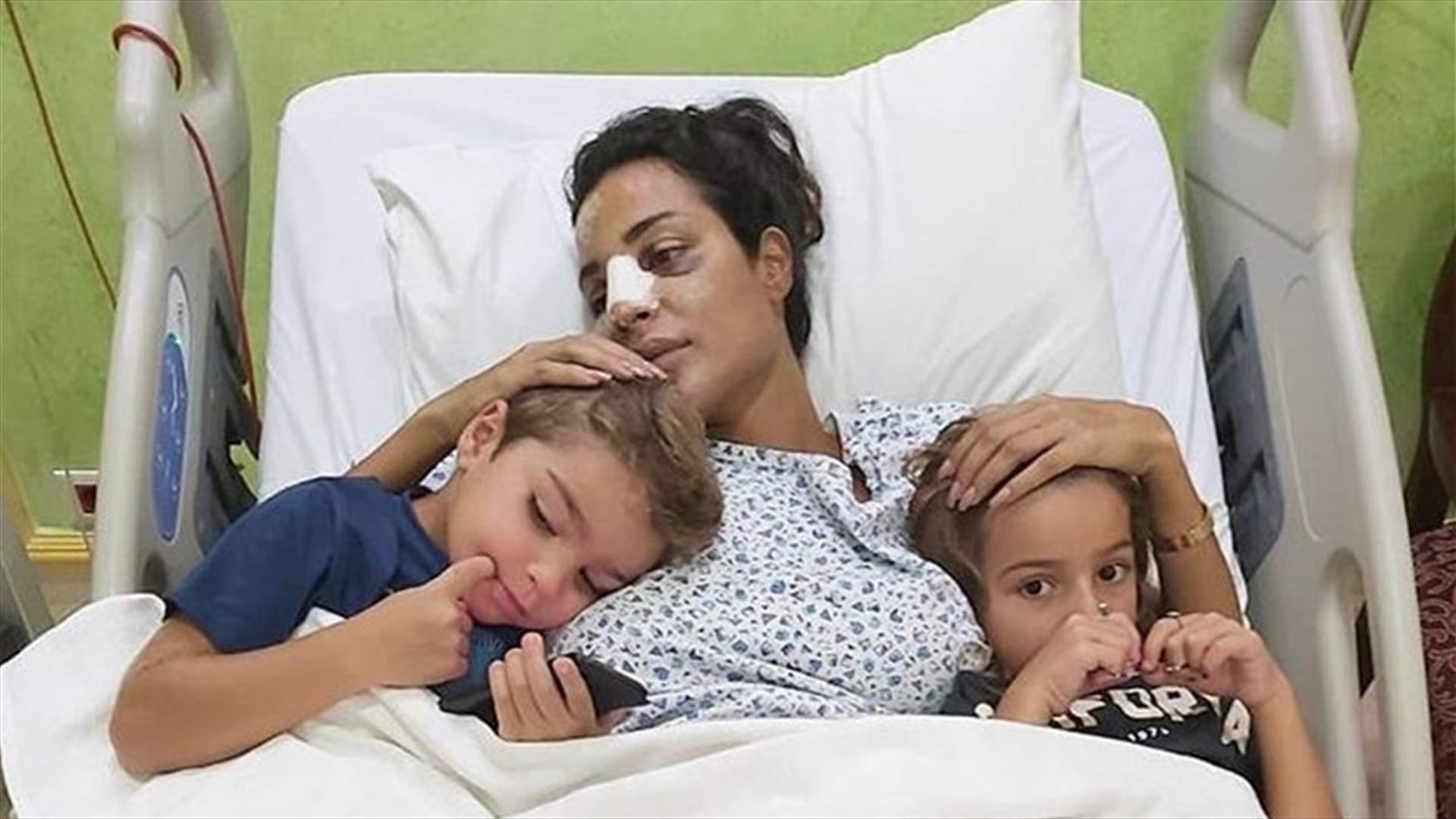 مغرّد يشكّك بإصابة نادين نسيب نجيم: "واضحة عملية تجميل".. والأخيرة تنفجر غضباً