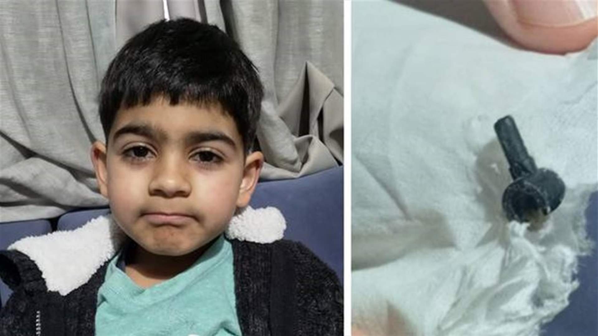 عثر على قطعة ليغو مفقودة داخل أنفه بعد عامين!