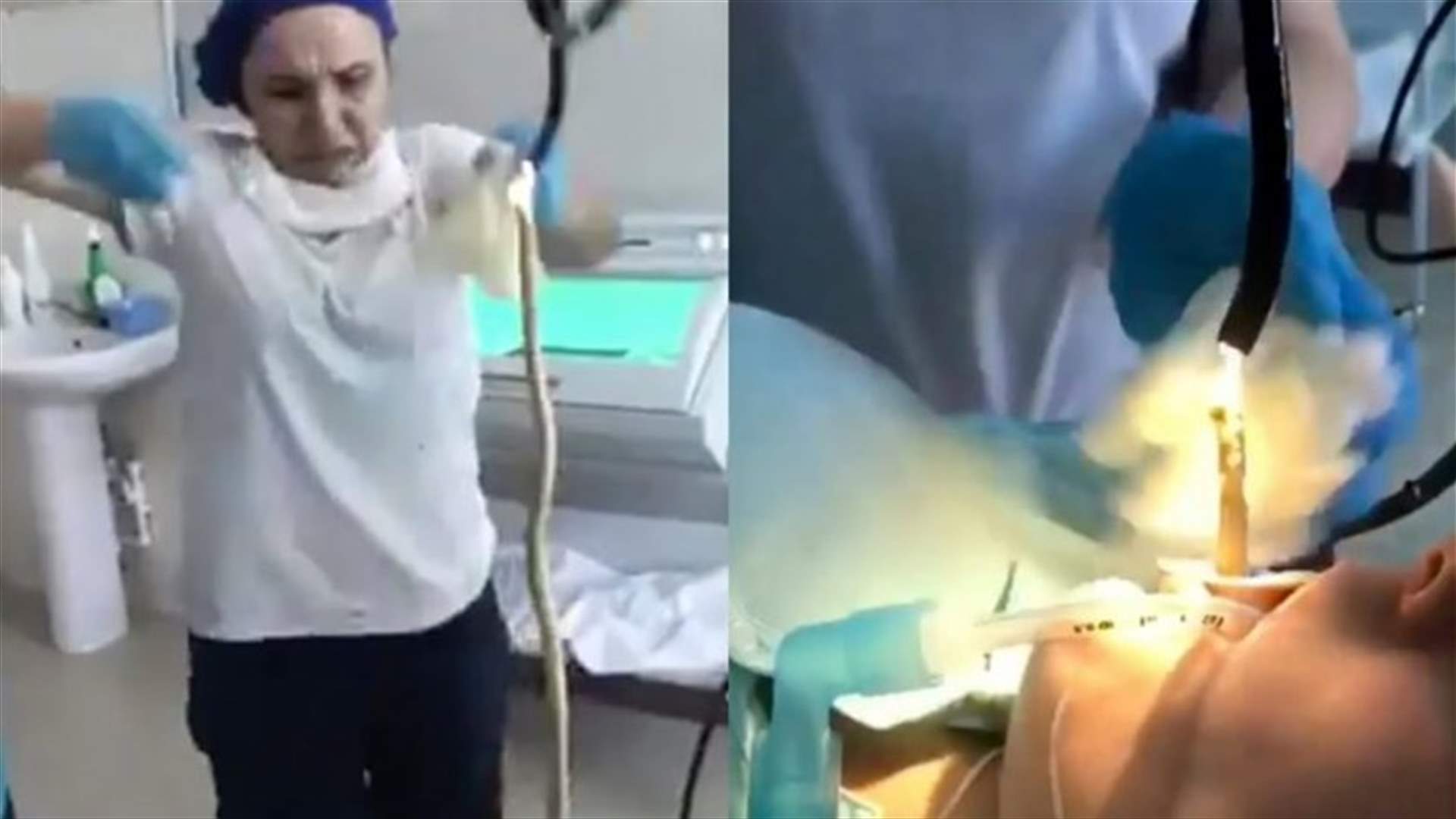 أطباء روس يحرّرون امرأة من ثعبان تسلّل إلى جسمها أثناء النوم (فيديو)