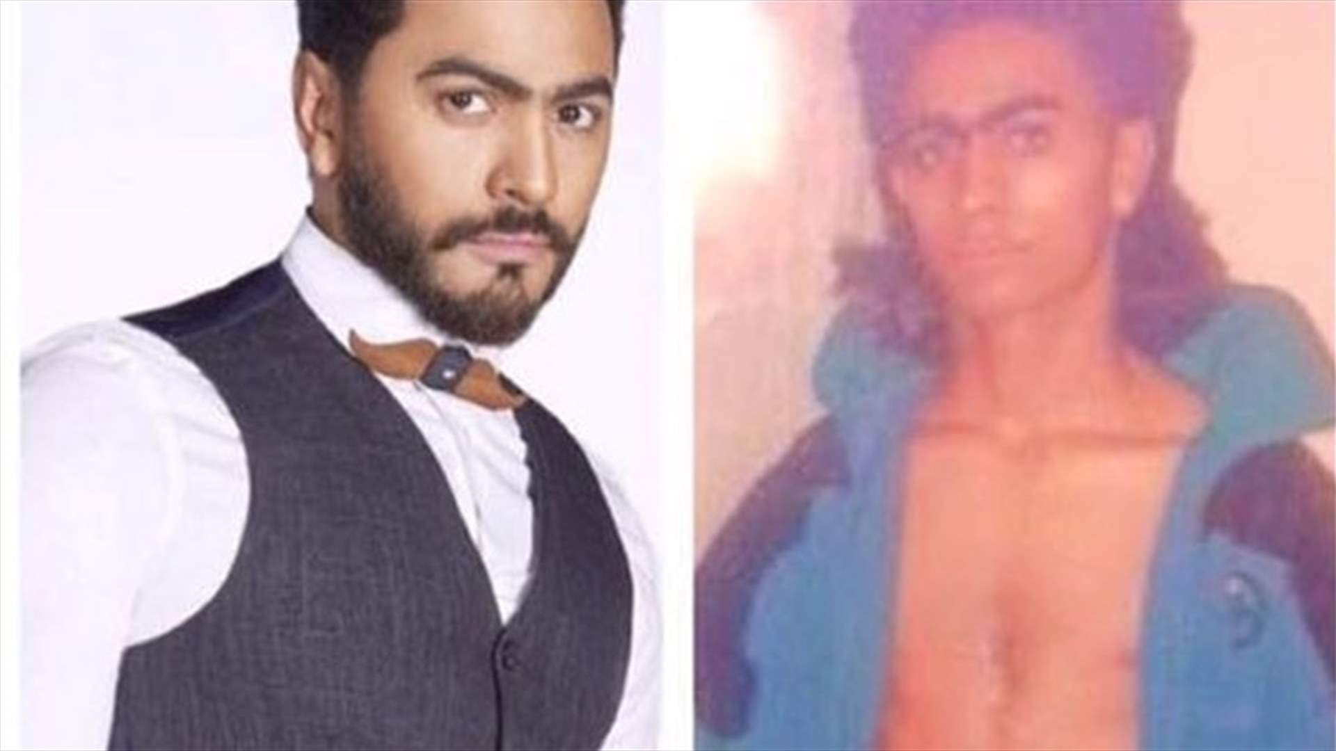 بعدما استهزأوا بـ "شياكته" وقميصه المفتوح قبل الشهرة.. تامر حسني يلقّن المتنمّرين درساً (فيديو)