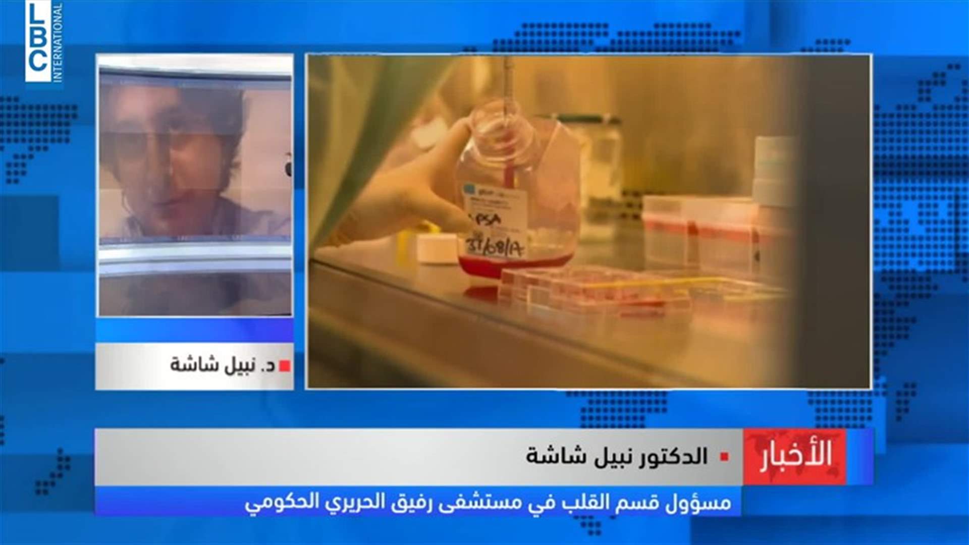 LBCI