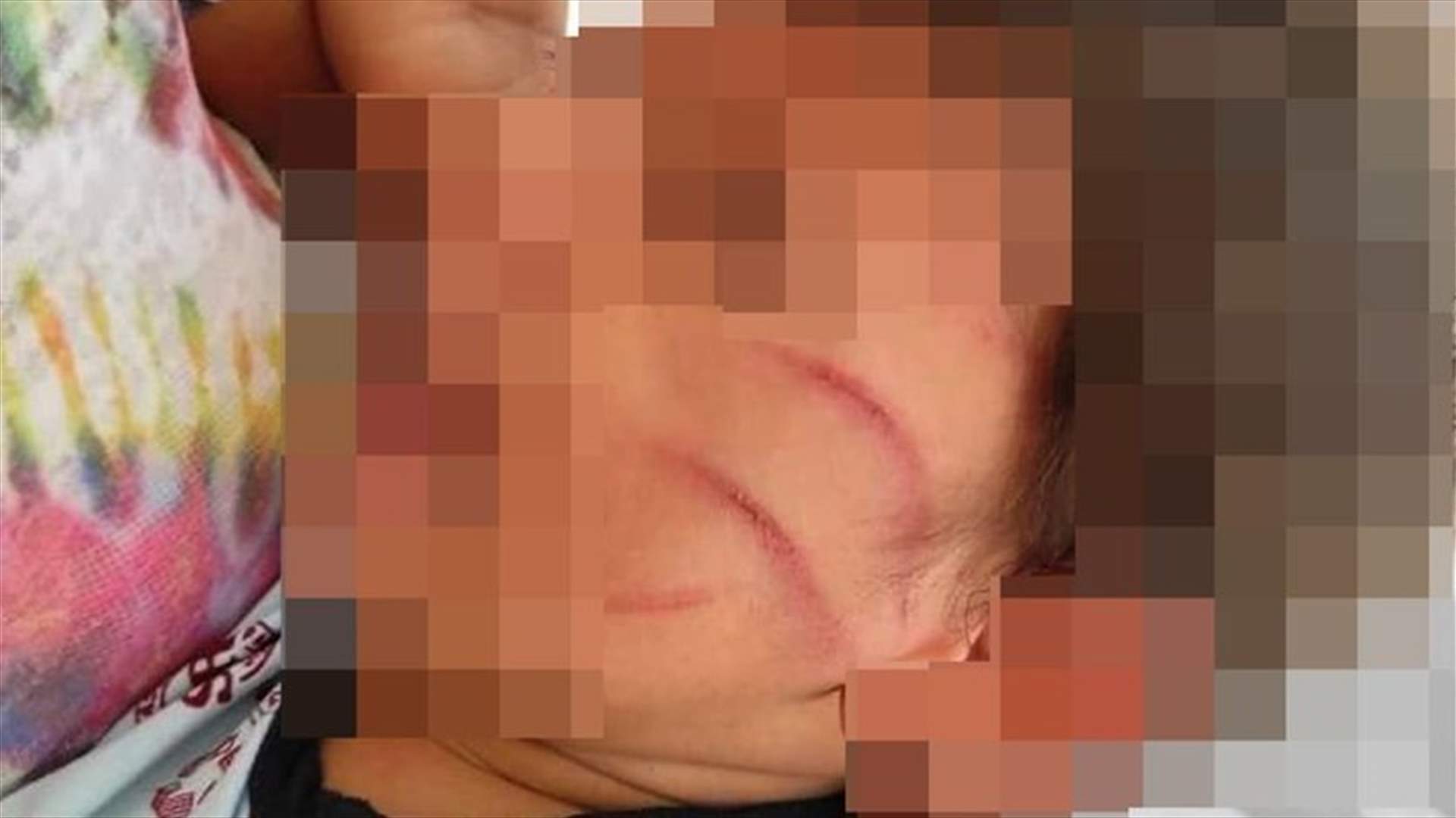 سيدة "تجلد" صبياً عمره سنتين... لأنه كسر غطاء هاتفها!