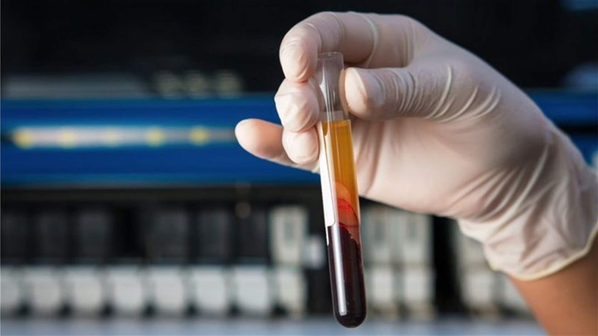 في بريطانيا... فحص دم تجريبي قد يكشف عن 50 نوعاً من السرطان