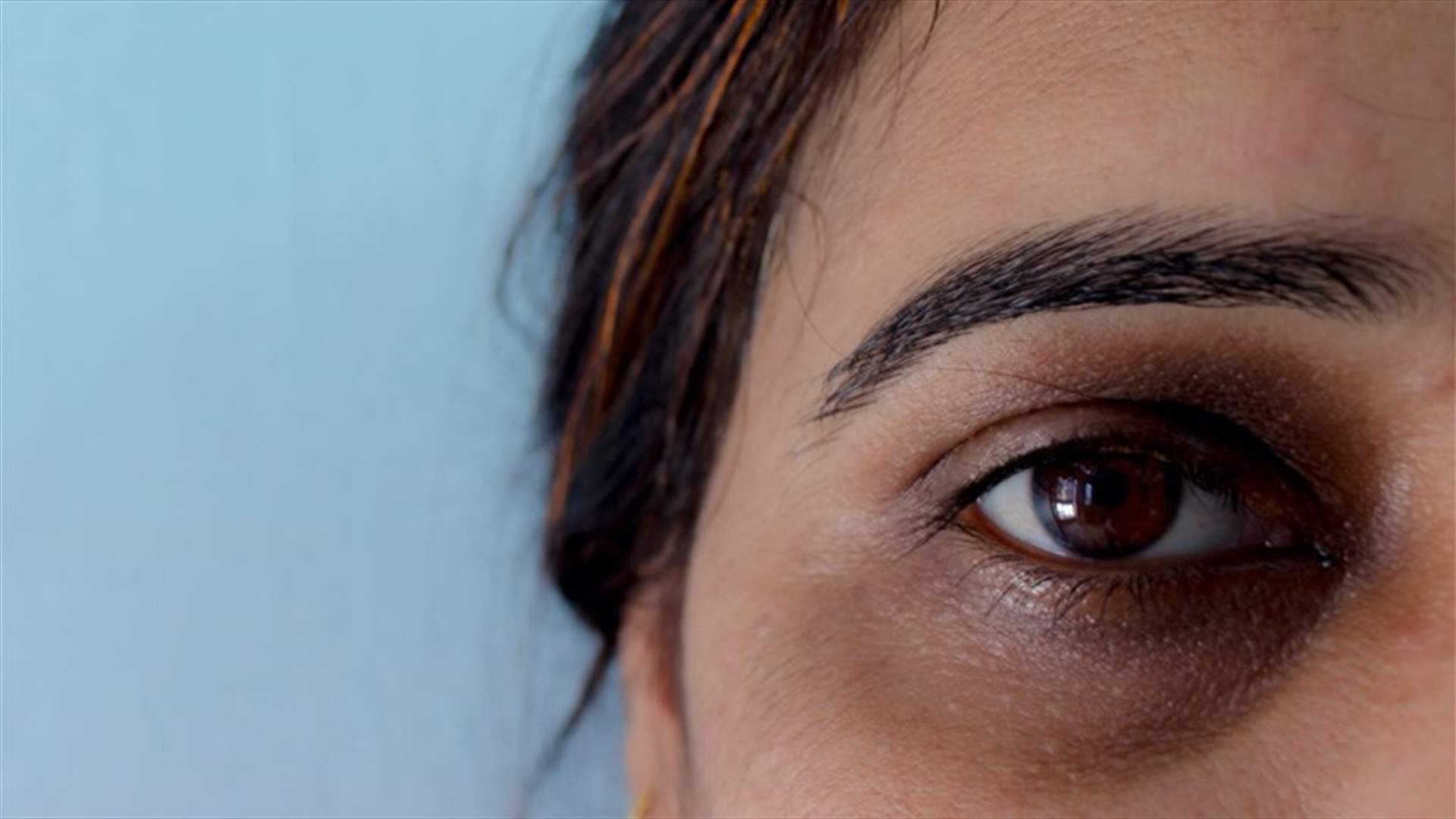 ما الذي يسبب ظهور الهالات السوداء حول العينين؟