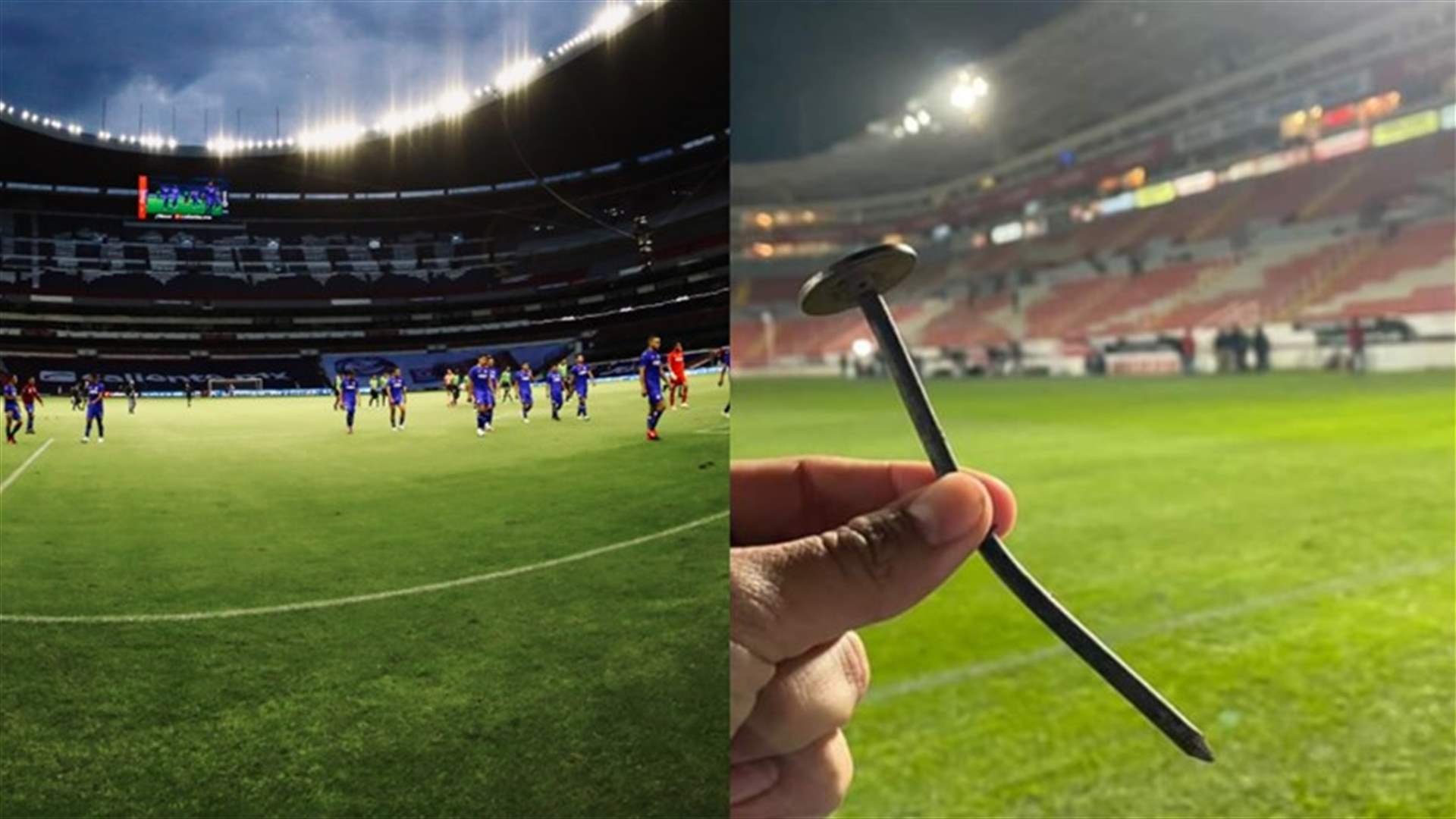 بسبب مسمار... لاعب كرة قدم يتعرّض لإصابة مروّعة في ركبته (صور)