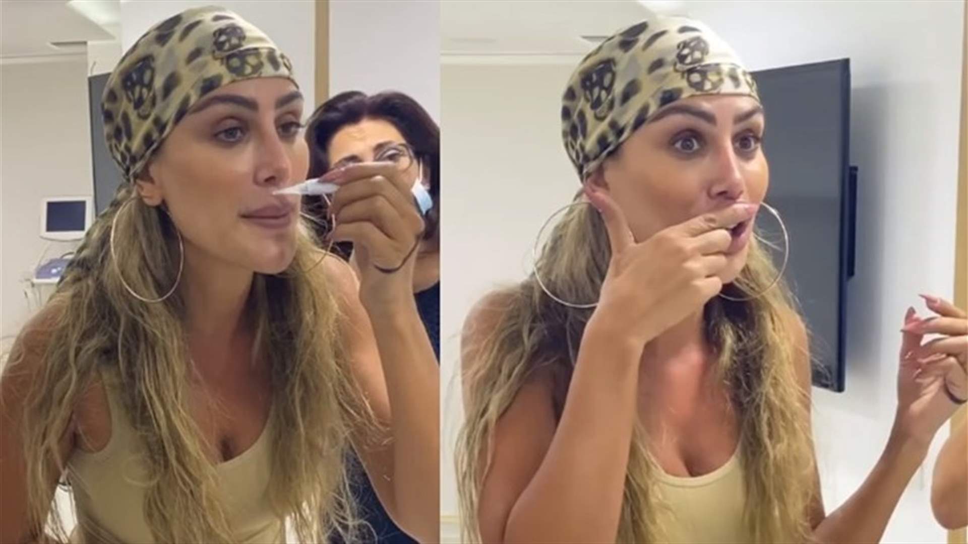 مايا دياب تستخدم "الغراء السريع" لتكبير شفتيها... شاهدوا رد فعل الطبيبة (فيديو)