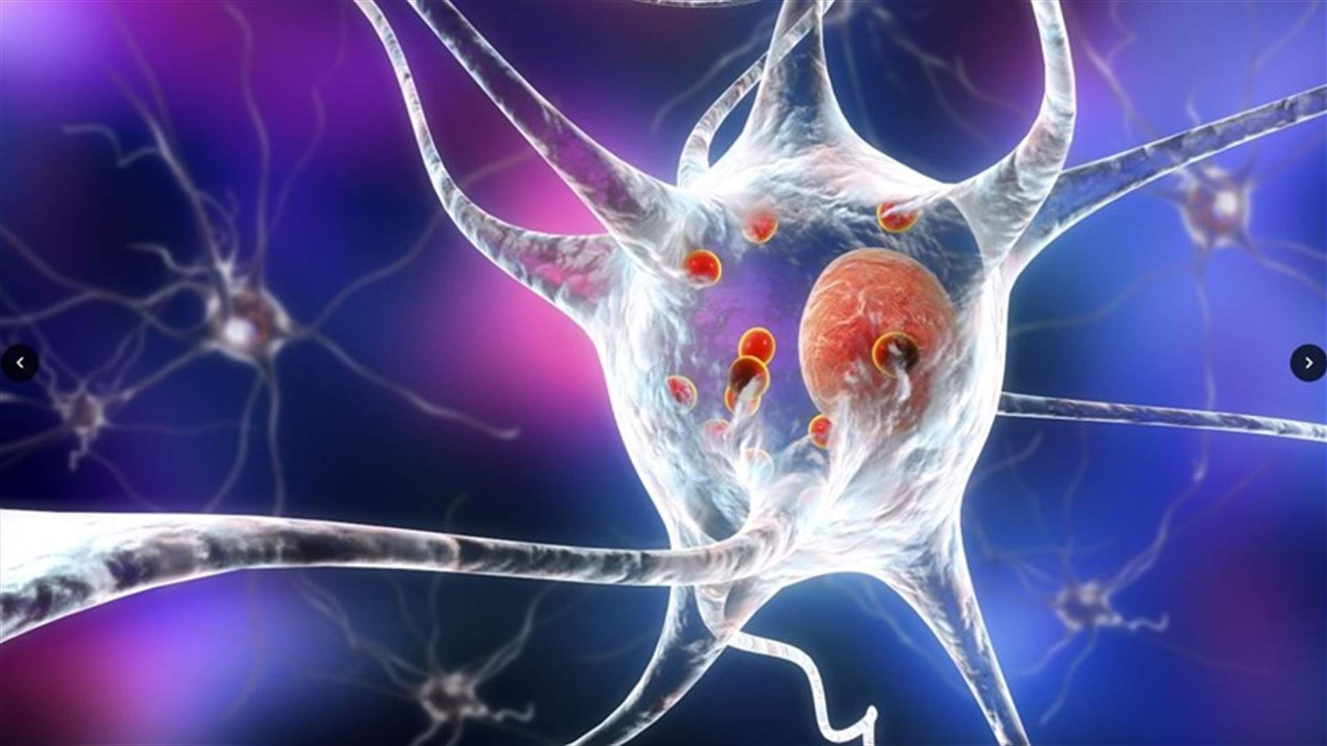 خطوة علمية نحو الأمام في تطوير علاج لمرض الباركنسون