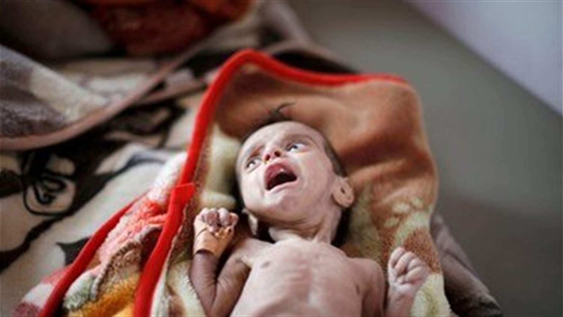 Yemen famine could threaten opportunity for peace, U.N. warns