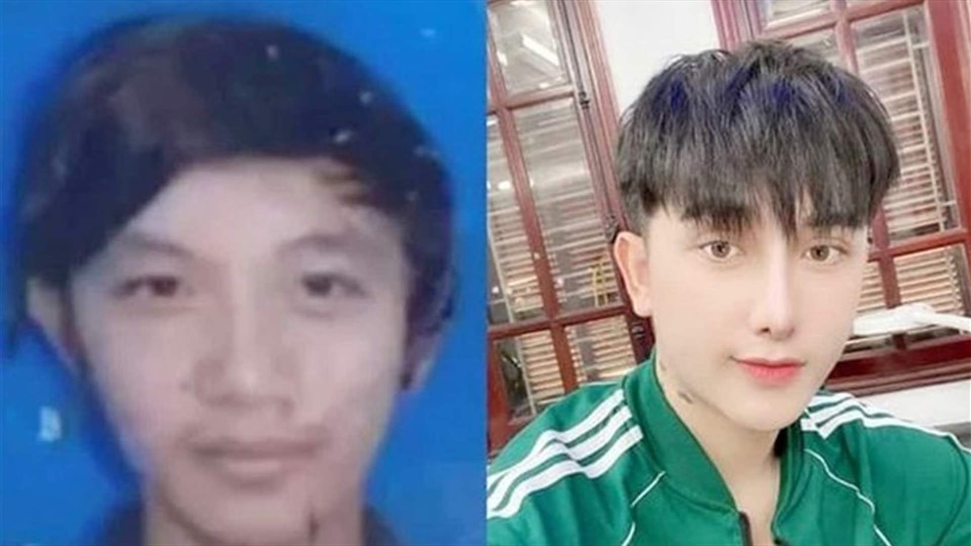 بعدما سخروا منه خلال مقابلة عمل... شاب يخضع لتسع عمليات تجميلية لتغيير مظهره (صور)