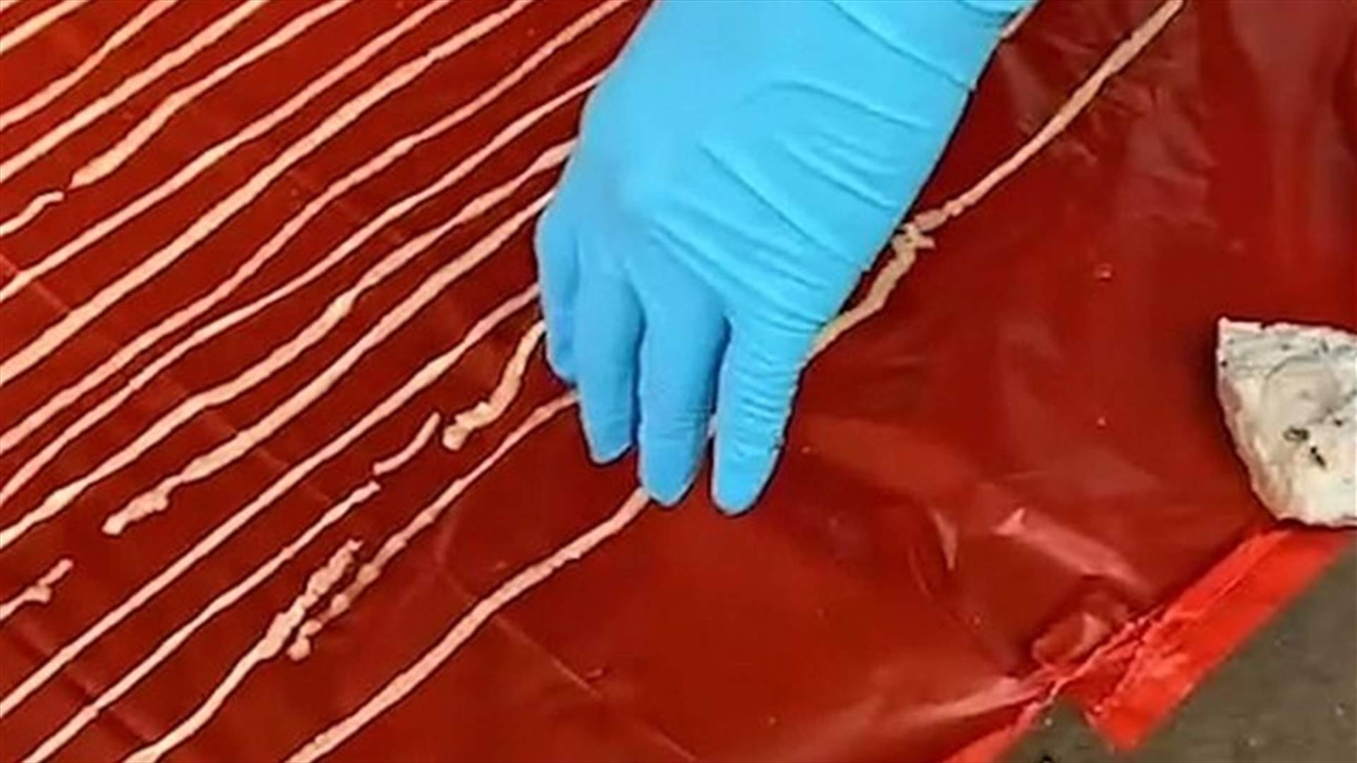 طولها 18 متراً... أطباء يستخرجون دودة من بطن مريض في تايلاند (فيديو)