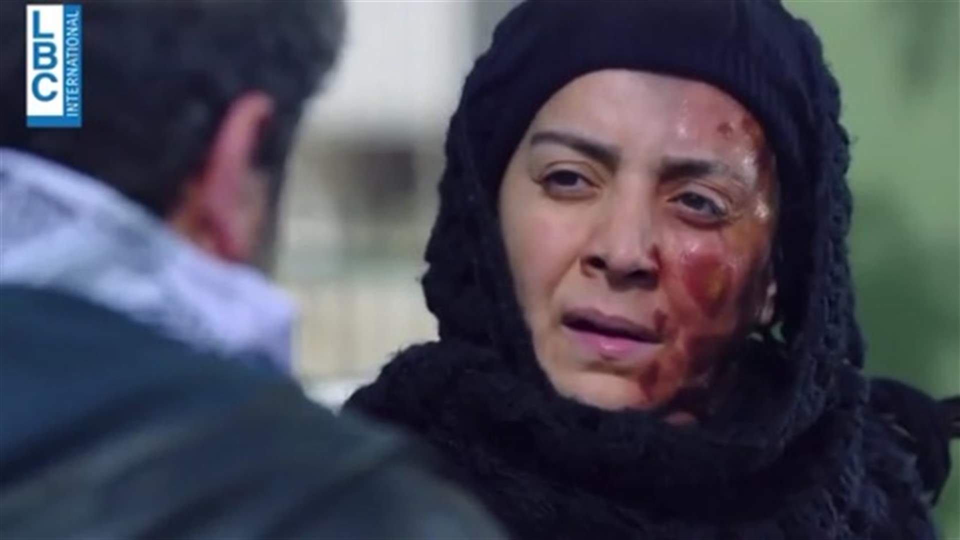 شكران مرتجى بوجهٍ مشوّهٍ في &quot;بانتظار الياسمين&quot; (فيديو)