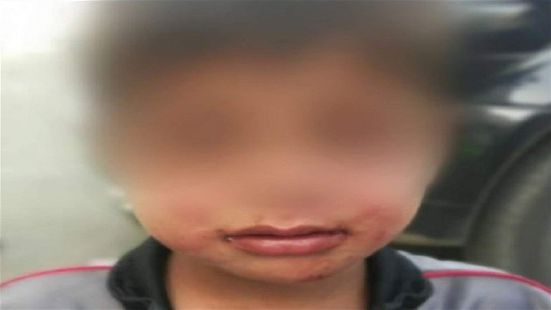 ضرب مبرح و"بالنبريش"...  طفلٌ ظنّ أنه يعيش مع "أبٍ"