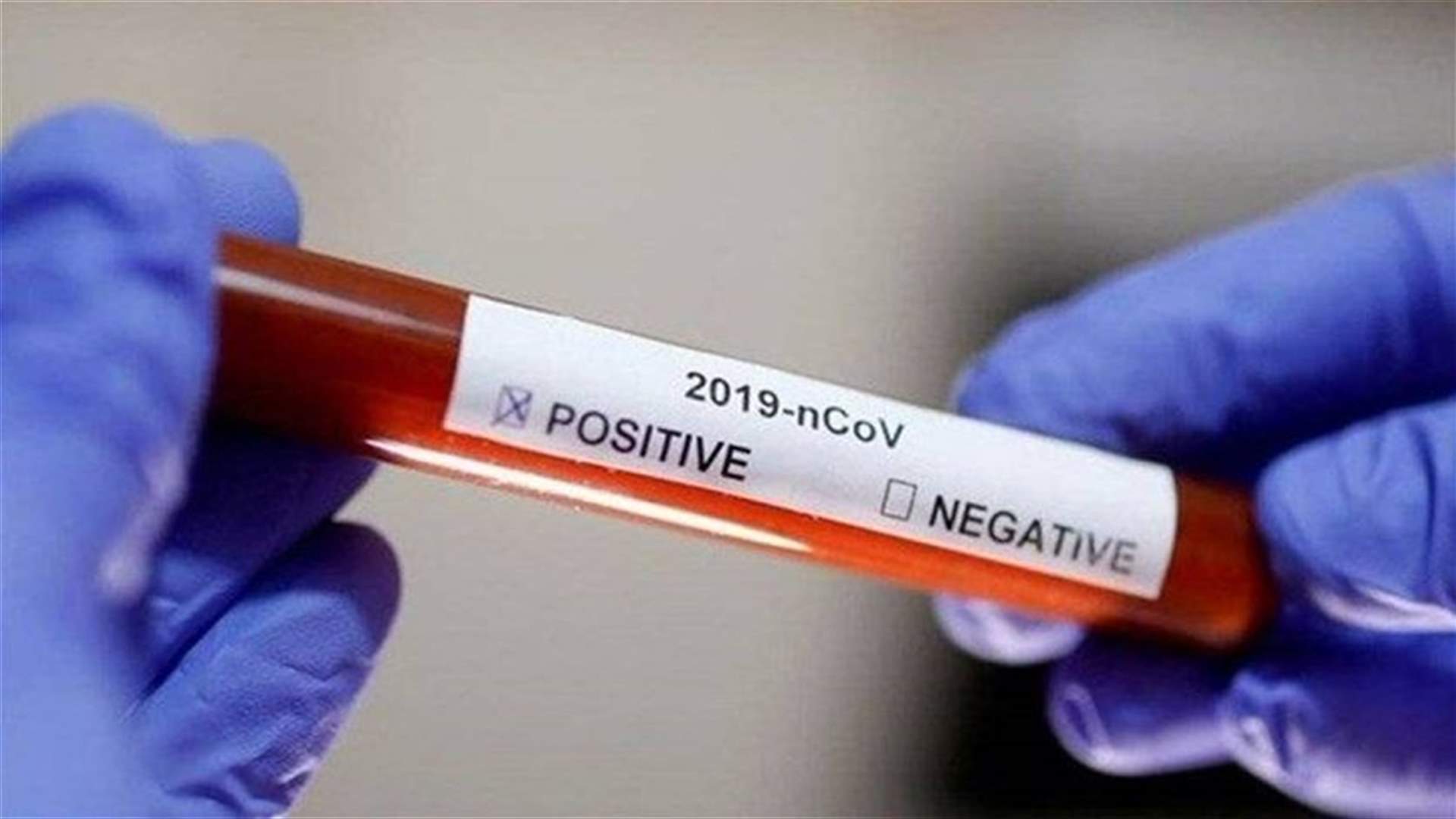 التجمع الطبي طالب بمجانية الـPCR لمعرفة الإصابات الحقيقية