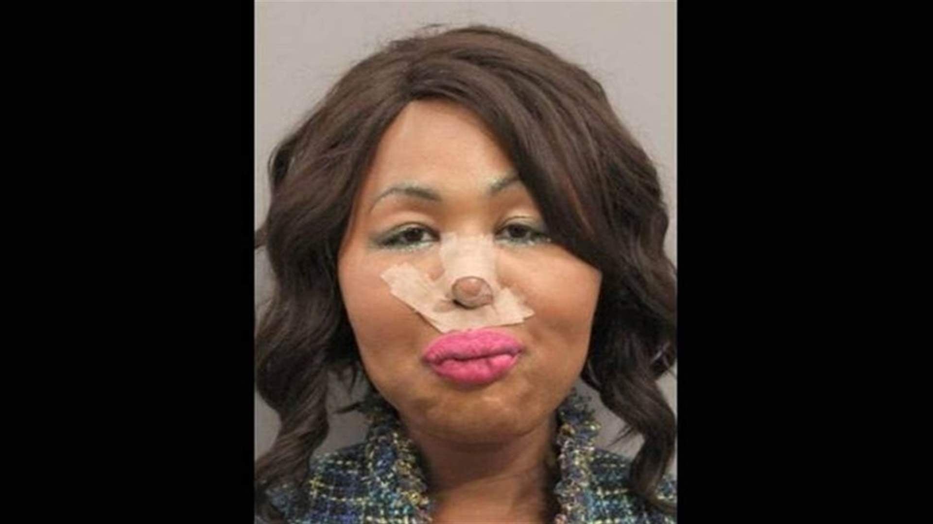 سرقت آلاف الدولارات من المصرف... لتغطية تكاليف عمليات التجميل في المكسيك!