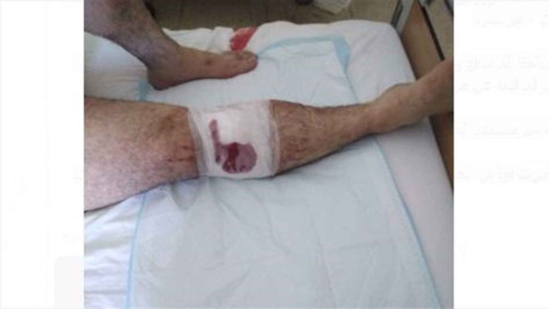 اشكال على افضلية مرور.. واصابة شخص