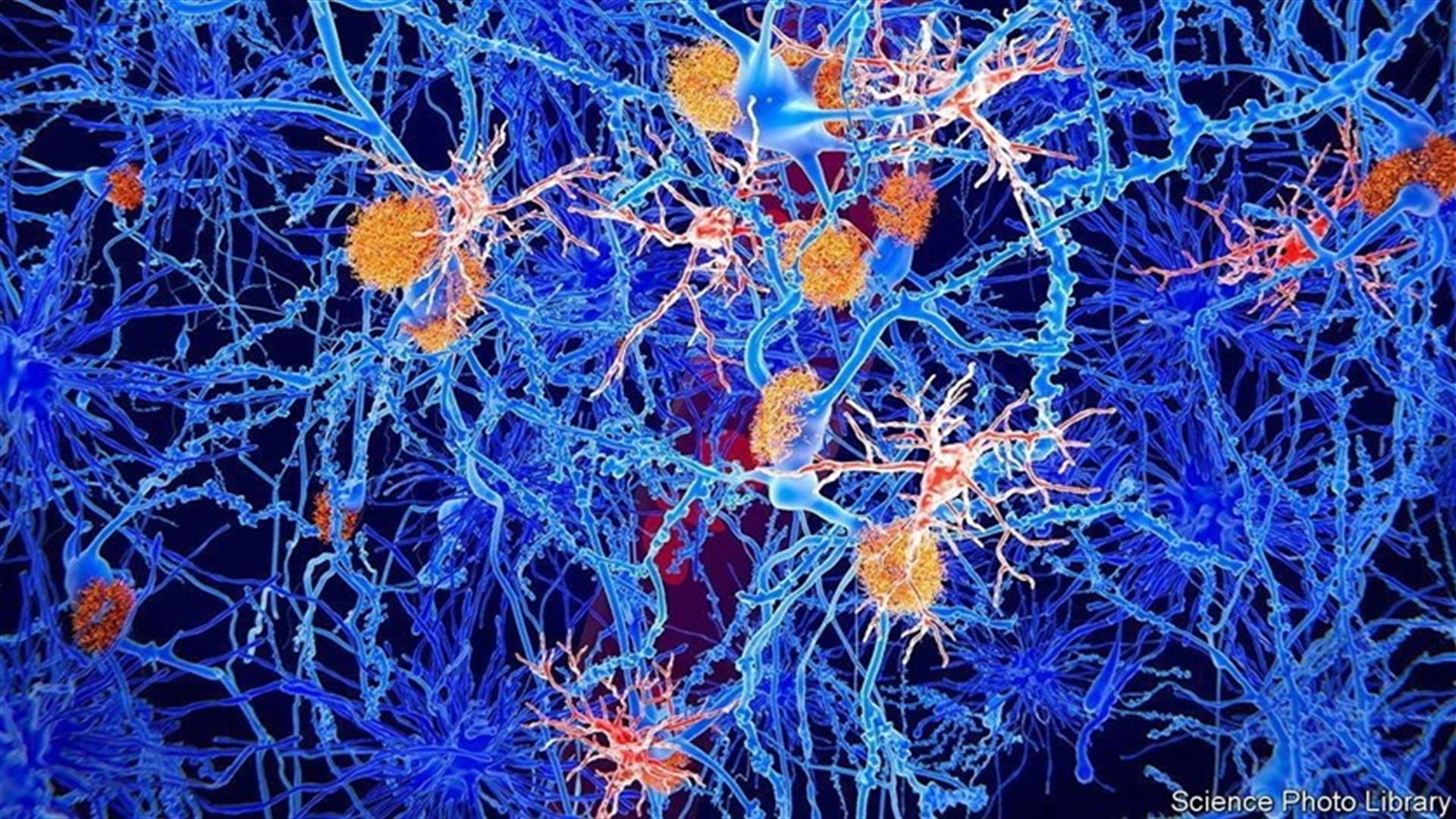 U.S. approval of Biogen Alzheimer&#39;s drug sends shares soaring, hailed as &#39;big day&quot; for patients