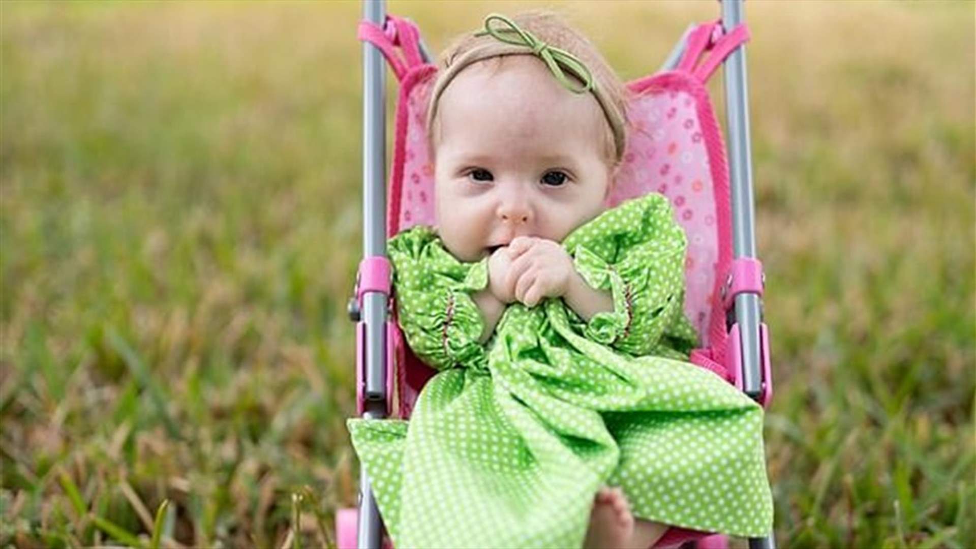 ولادة طفلة بنوع نادر من التقزّم... نموّها الجسدي سيتوقف عند بلوغ 60 سم فقط! (صور)