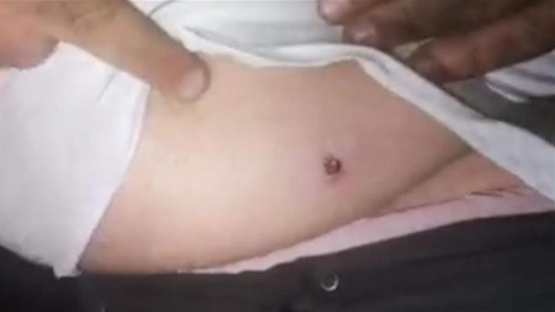 هذا ما حصل على دوار بيستاشو في الميناء... احتجاج واطلاق نار