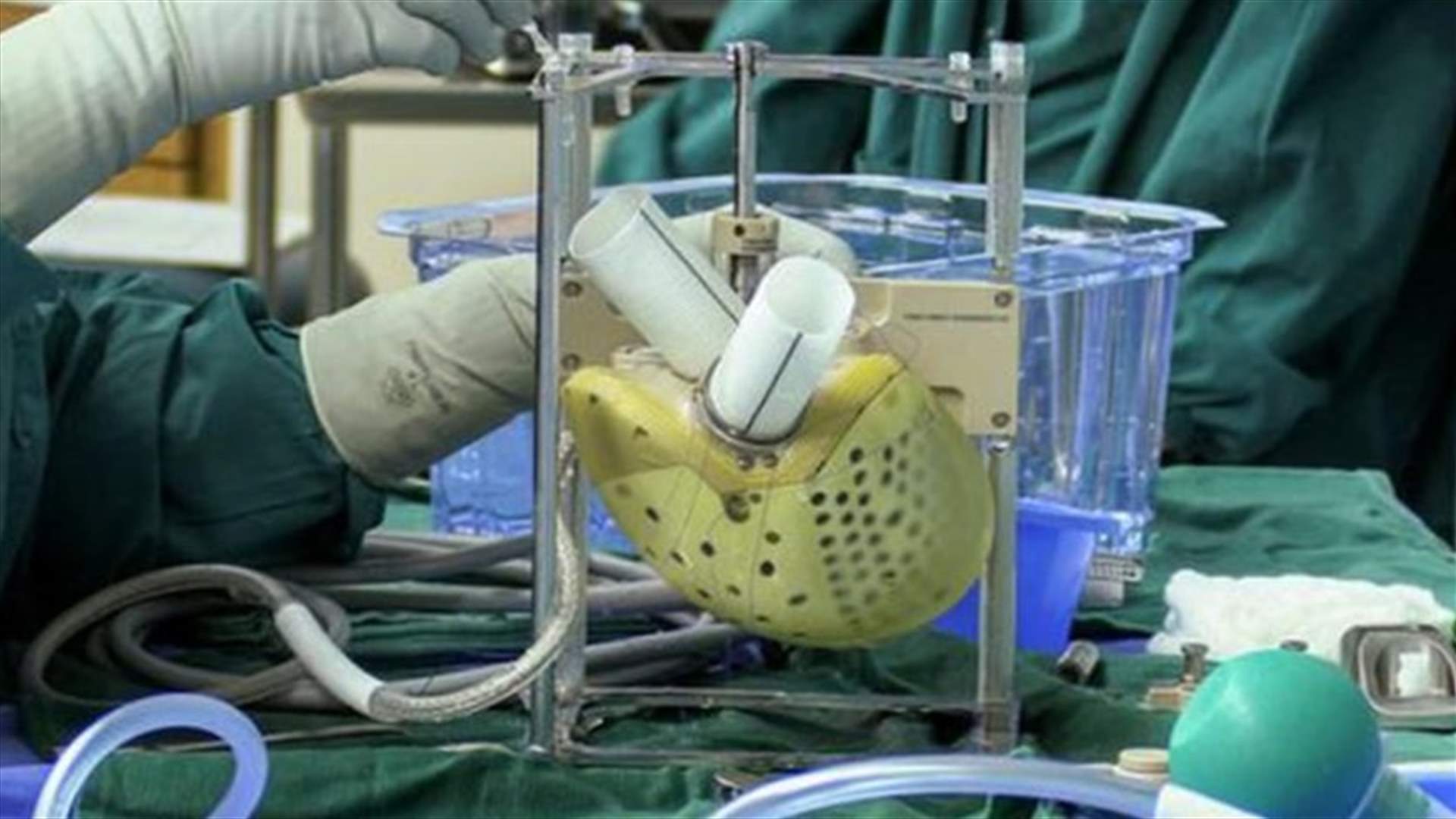 استُخدم في جسم مريض إيطالي... شركة فرنسية تبيع قلباً اصطناعياً للمرّة الأولى منذ إنشائها (صور)