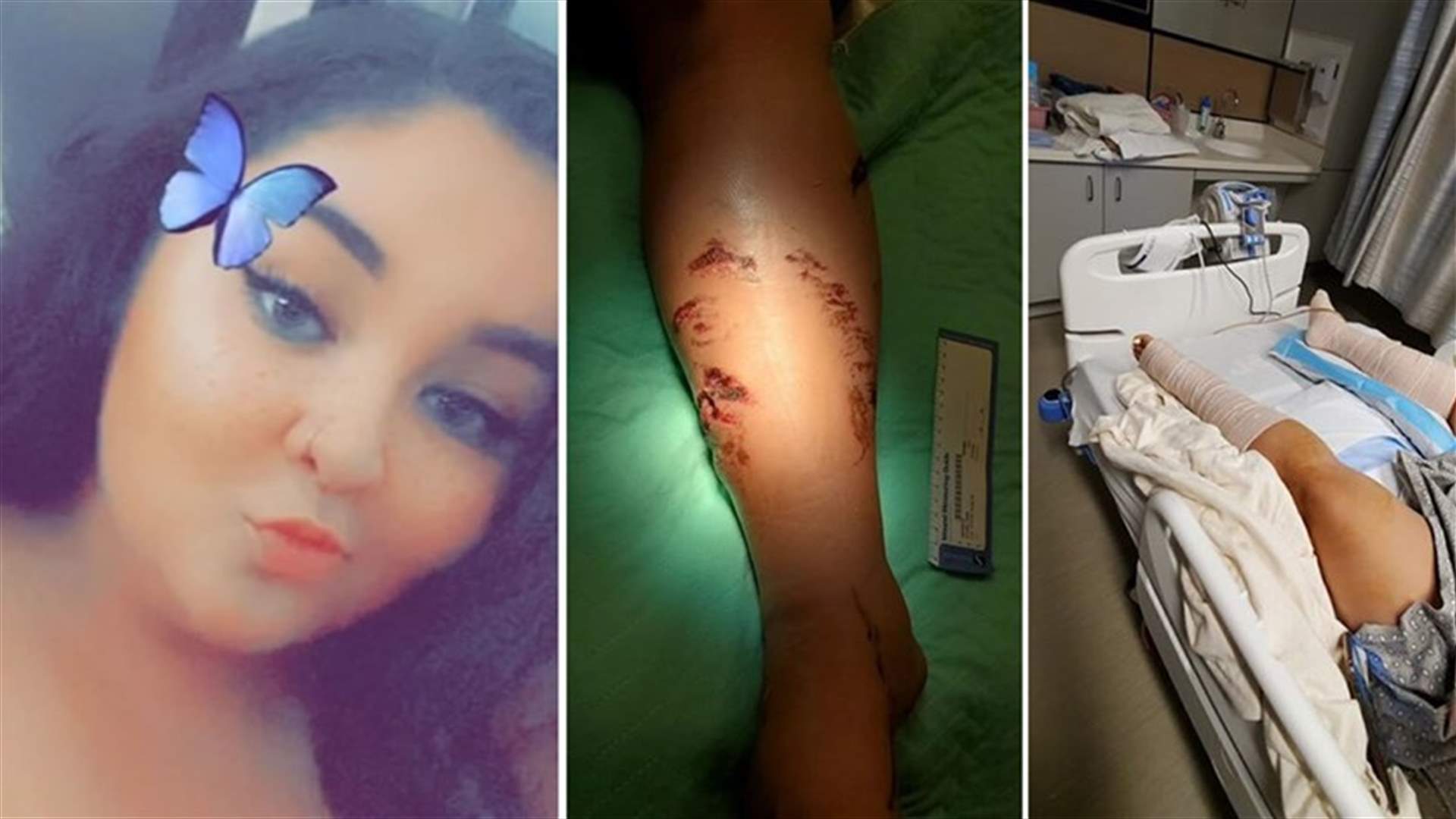 في حادثة مروعة ... تمساح يهاجم فتاة أثناء إجازتها في منتجع سياحي في المكسيك